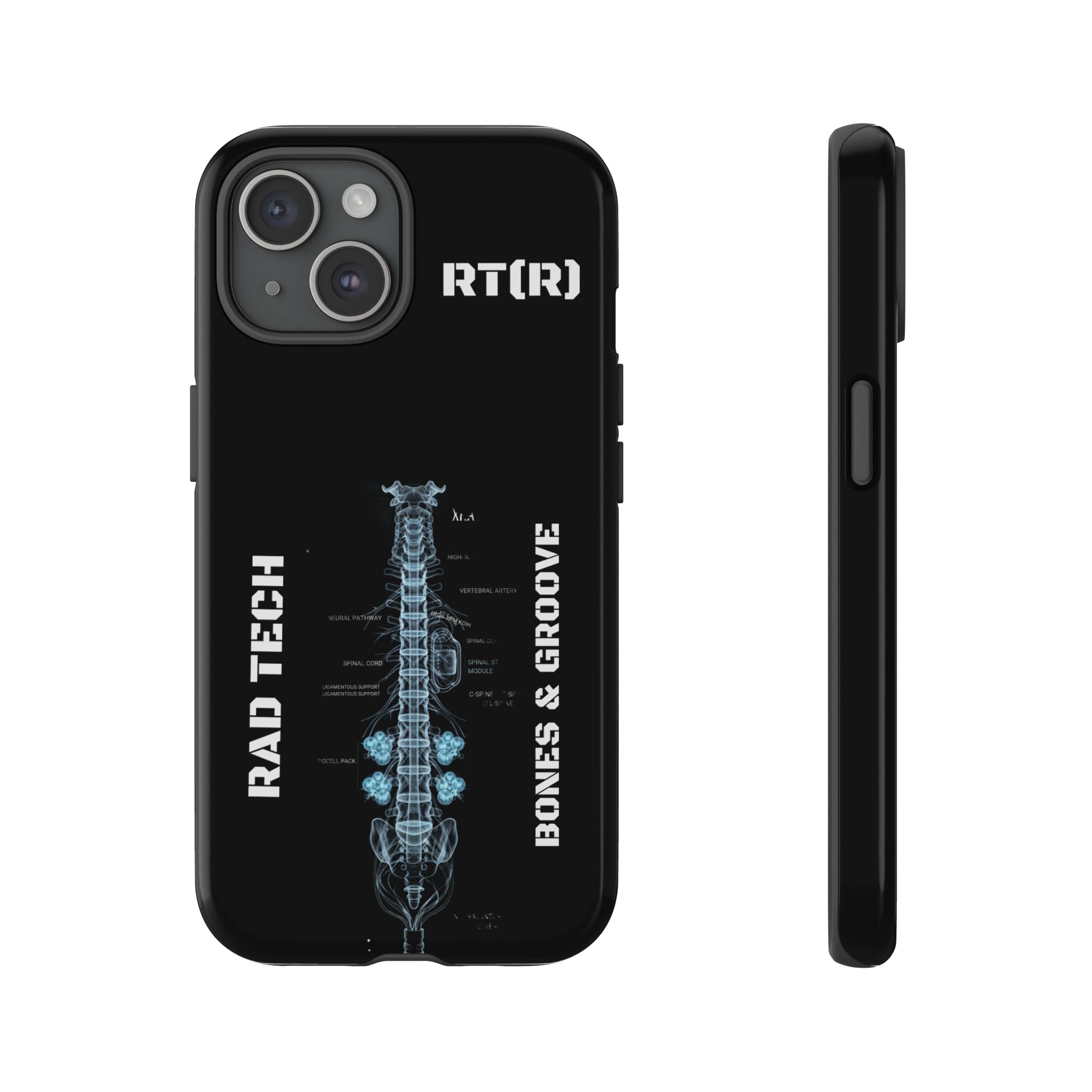RAD TECH -Aesthetic Phone Case