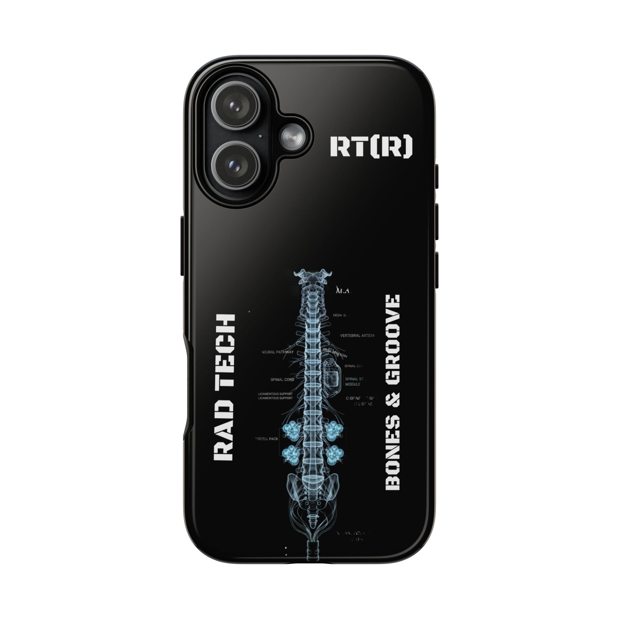 RAD TECH -Aesthetic Phone Case