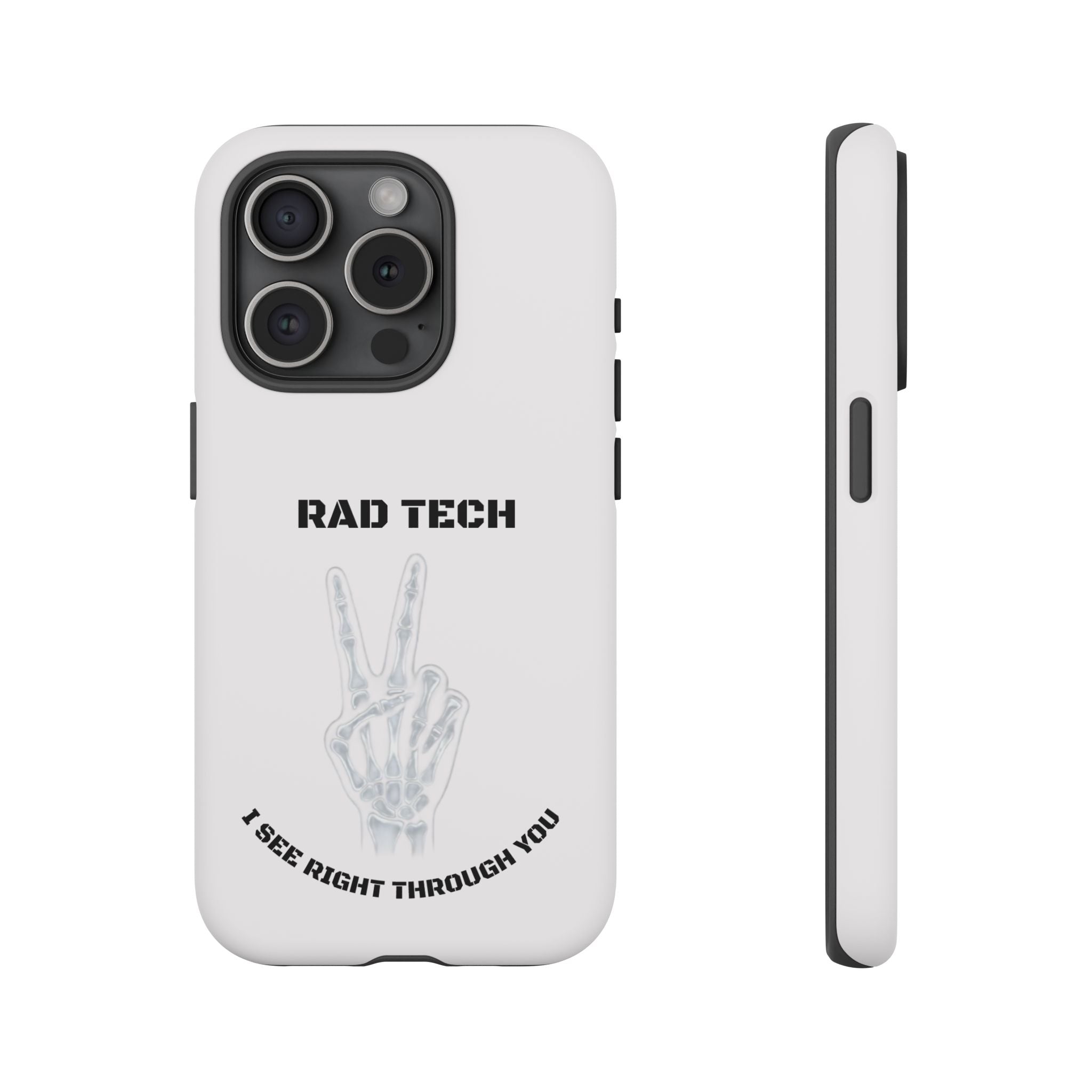 Rad Tech Phone Case — Skeleton Hand "I See Right Through You" X-ray Technician Gift