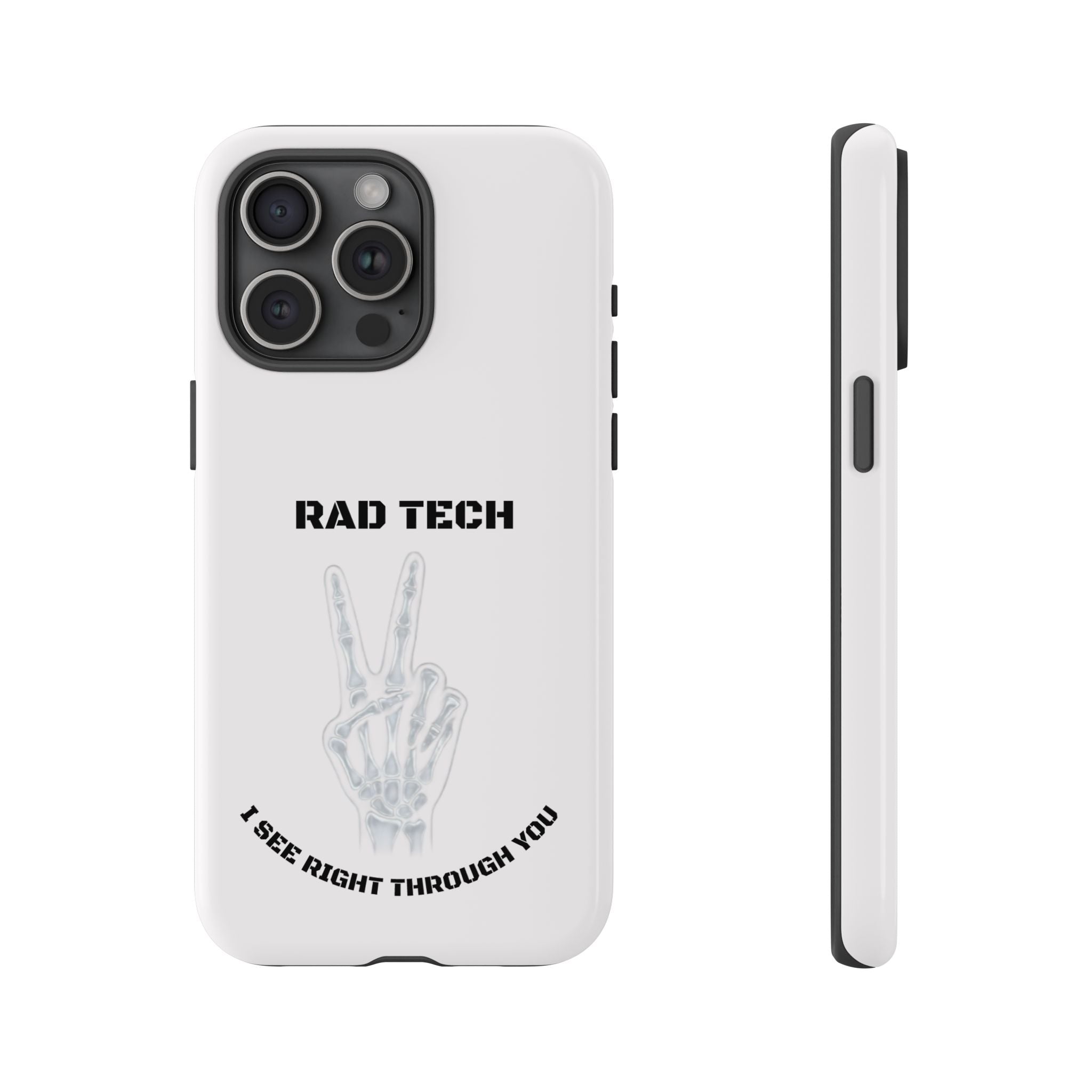 Rad Tech Phone Case — Skeleton Hand "I See Right Through You" X-ray Technician Gift