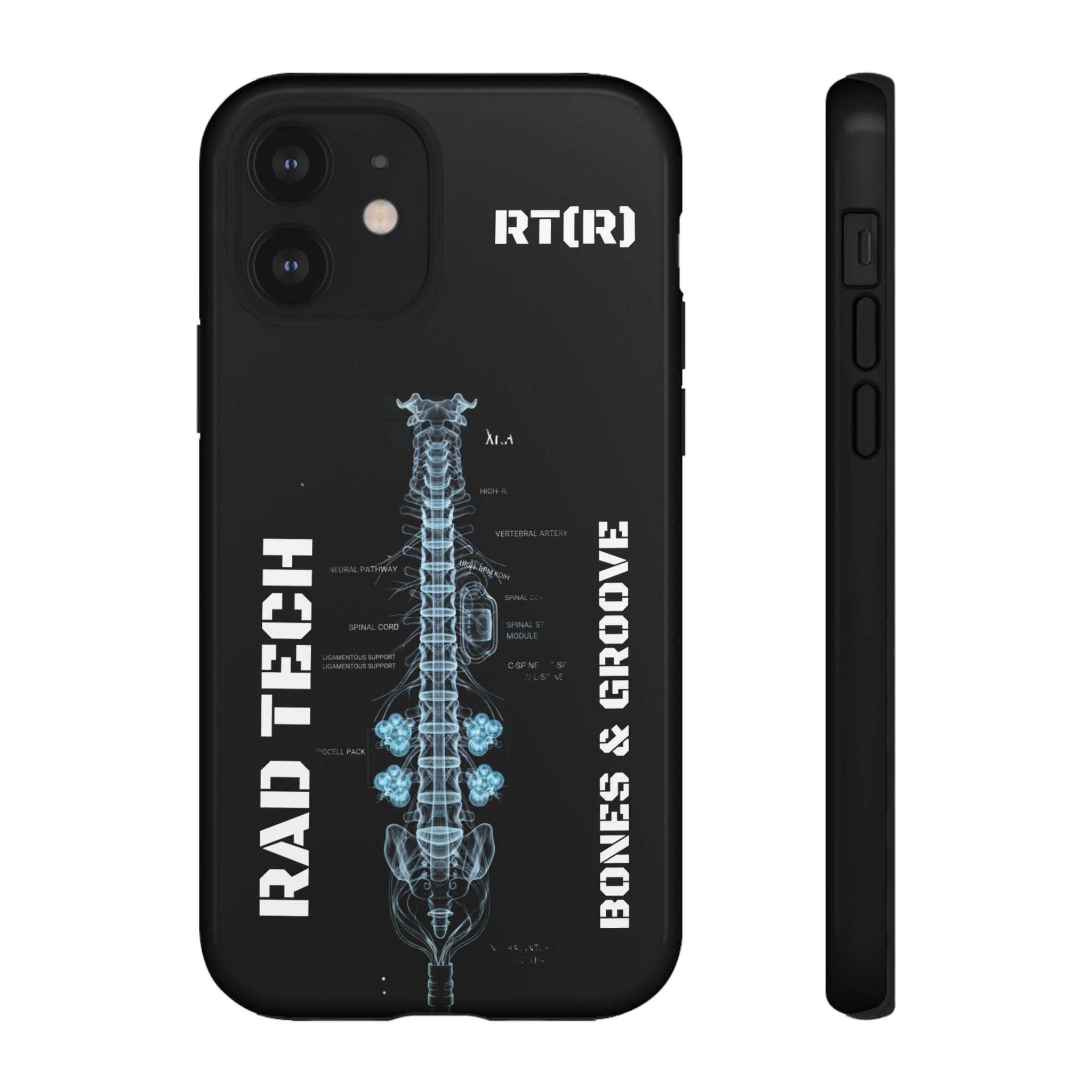 RAD TECH -Aesthetic Phone Case