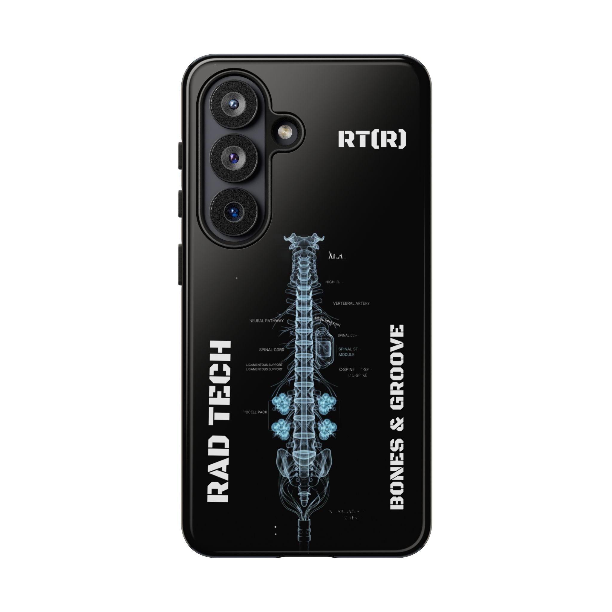 RAD TECH -Aesthetic Phone Case