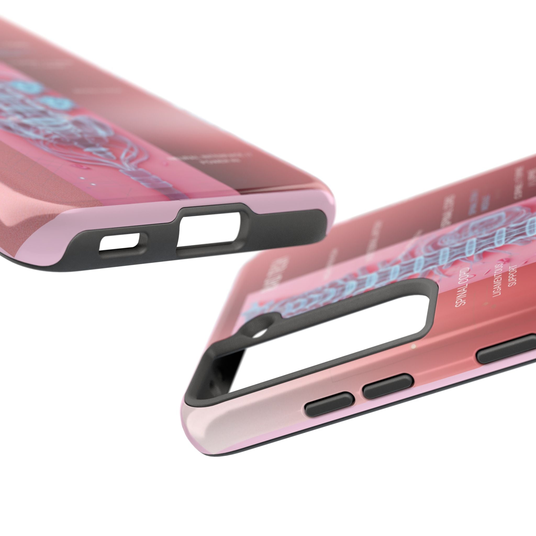 Anatomical Spine Tough Phone Case — Medical X-Ray Design, ‘Spinal Cord’ Labelled