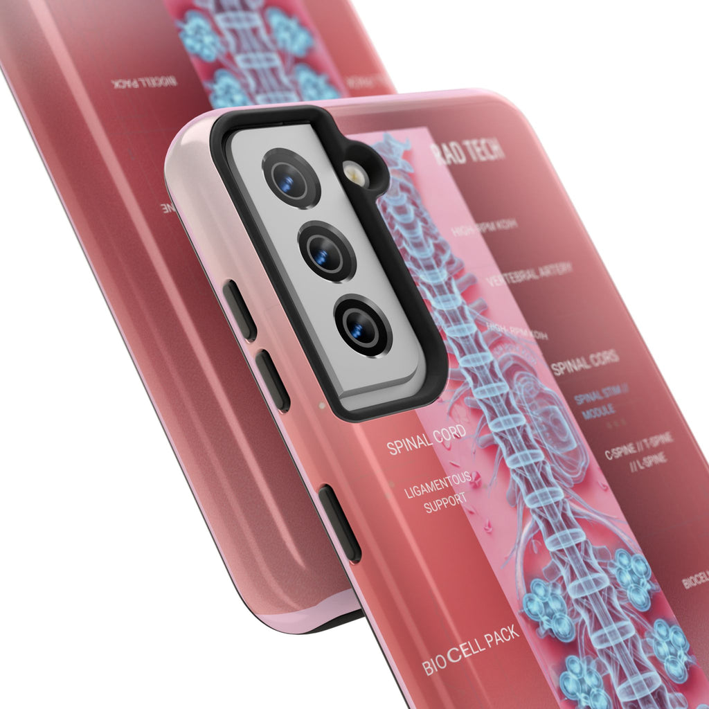 Anatomical Spine Tough Phone Case — Medical X-Ray Design, ‘Spinal Cord’ Labelled
