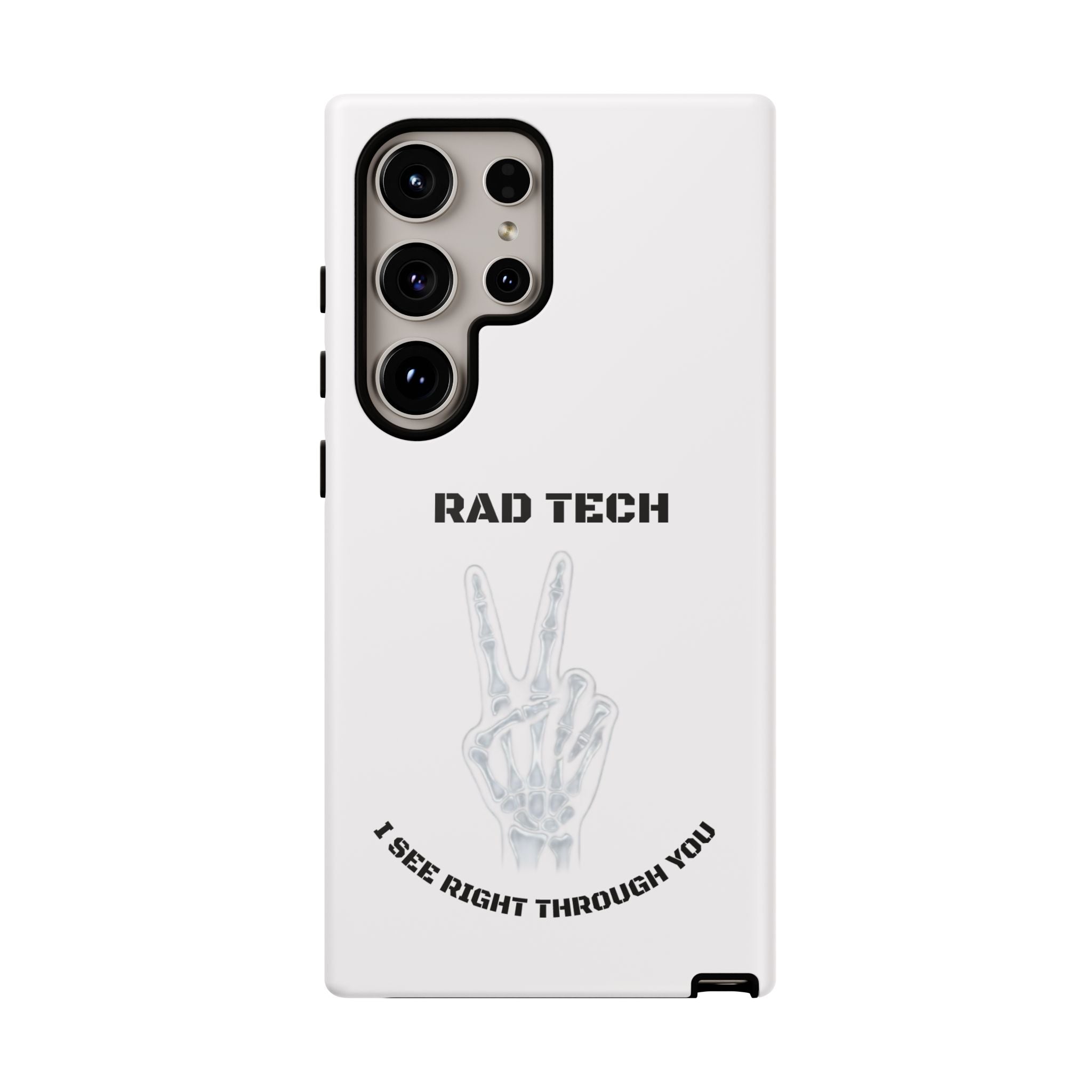 Rad Tech Phone Case — Skeleton Hand "I See Right Through You" X-ray Technician Gift