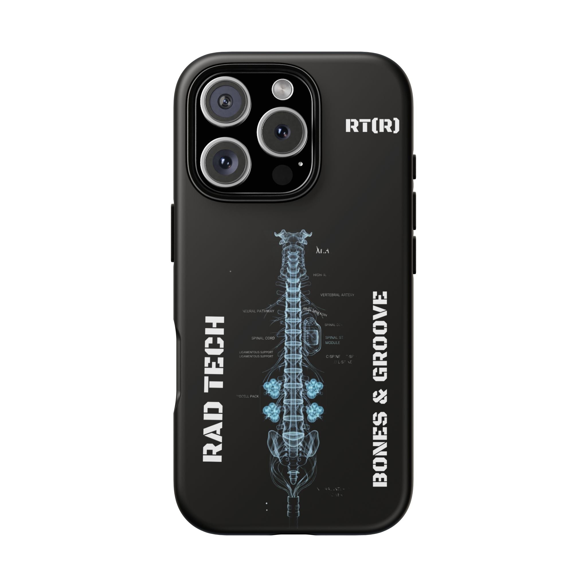 RAD TECH -Aesthetic Phone Case
