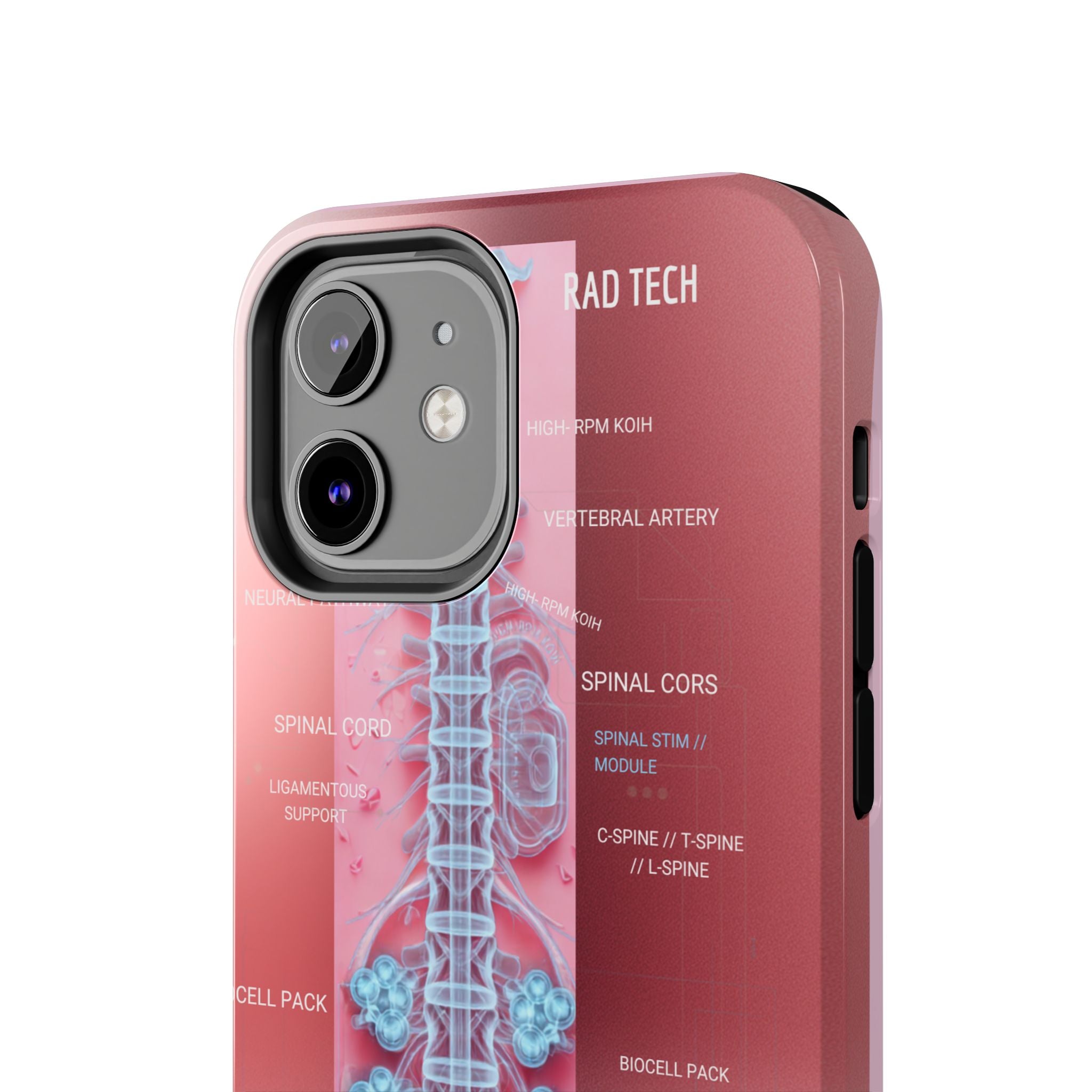 Anatomical Spine Tough Phone Case — Medical X-Ray Design, ‘Spinal Cord’ Labelled