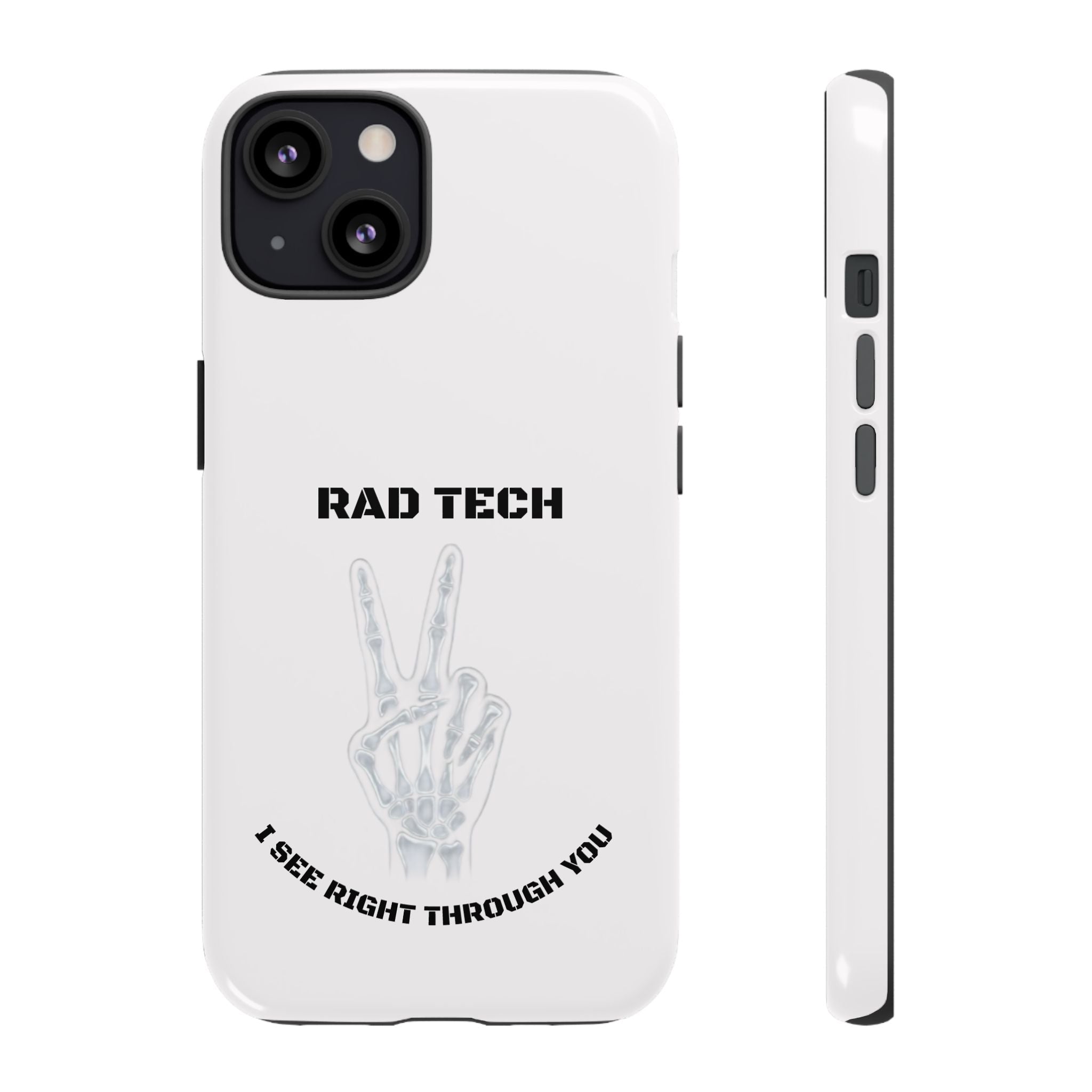 Rad Tech Phone Case — Skeleton Hand "I See Right Through You" X-ray Technician Gift
