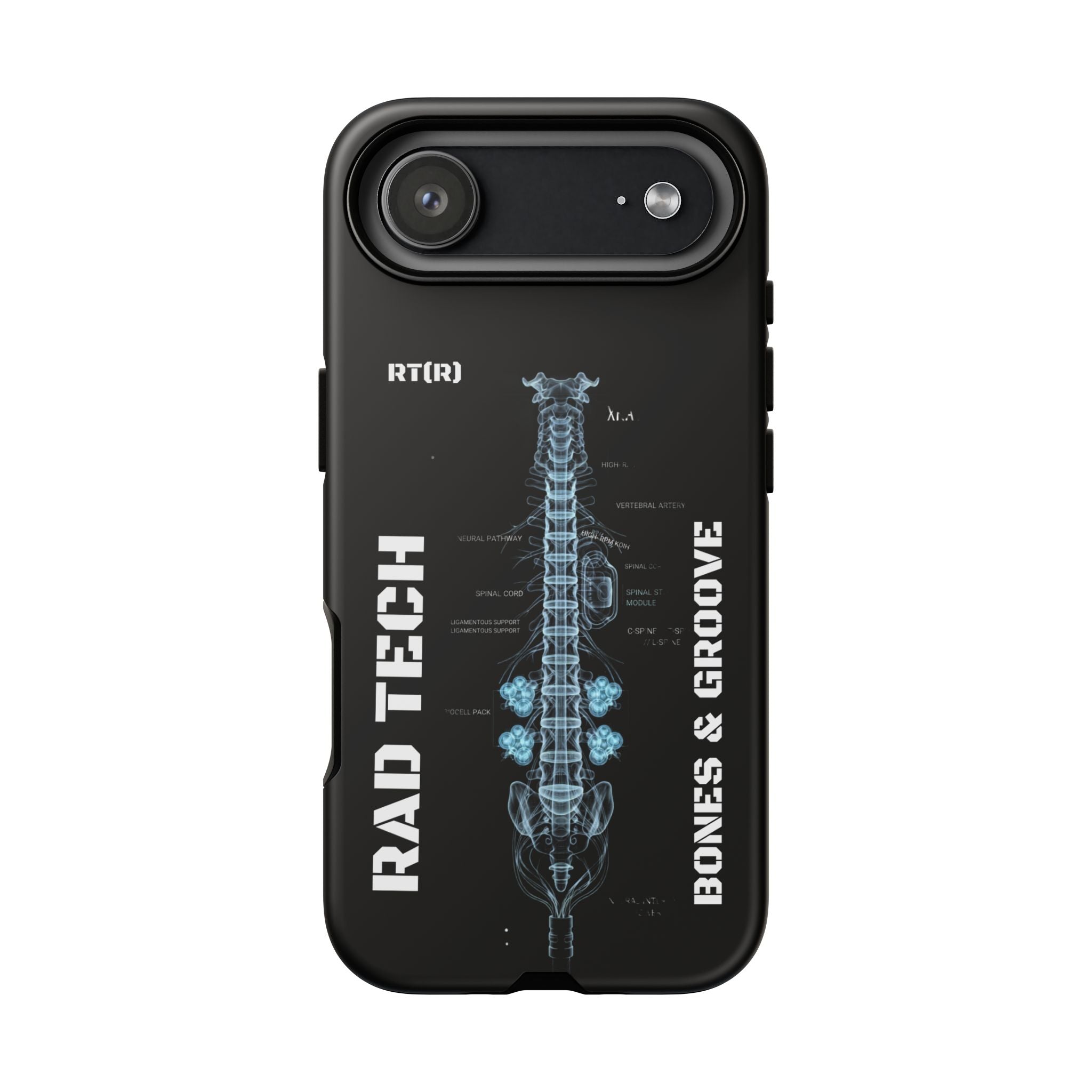 RAD TECH -Aesthetic Phone Case