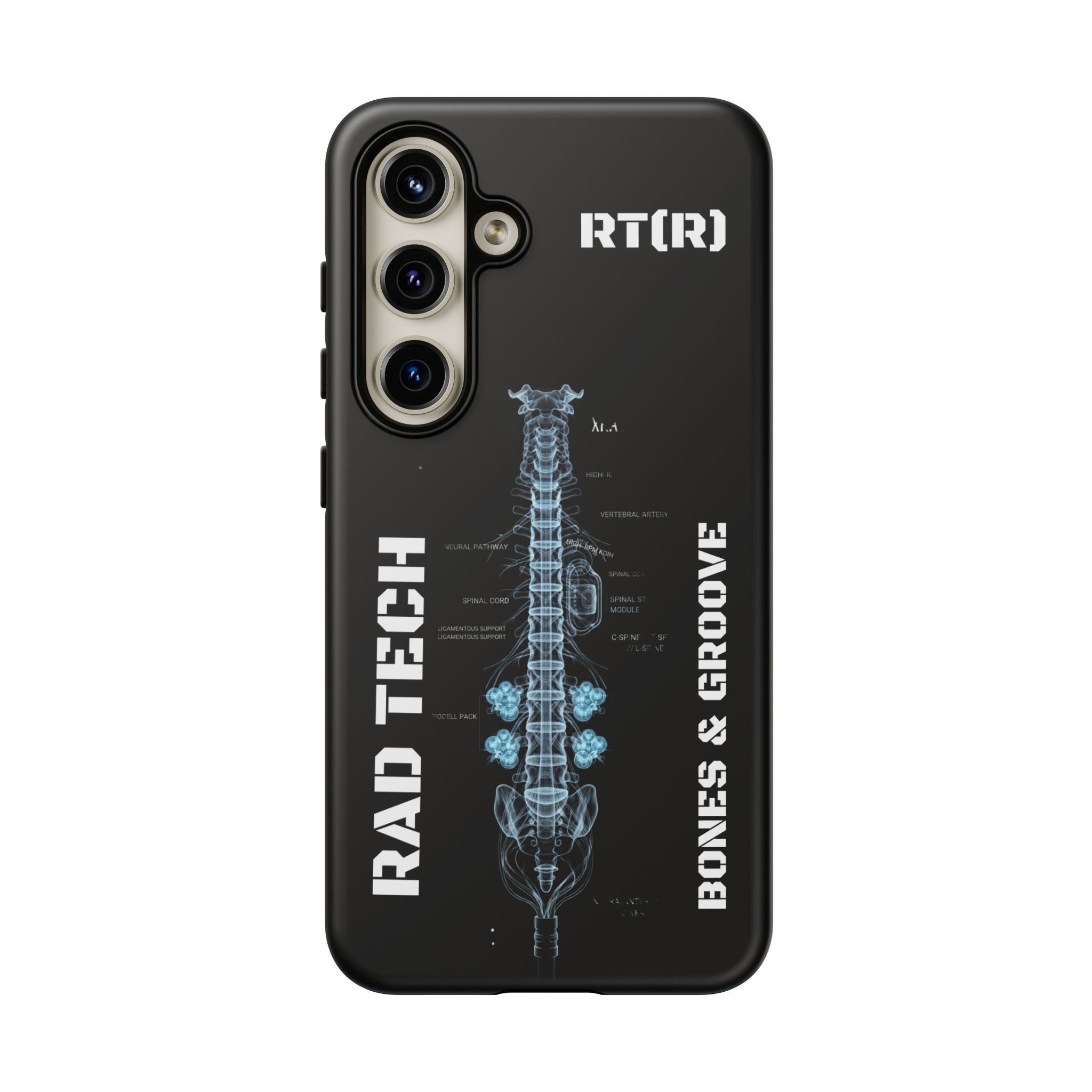 RAD TECH -Aesthetic Phone Case