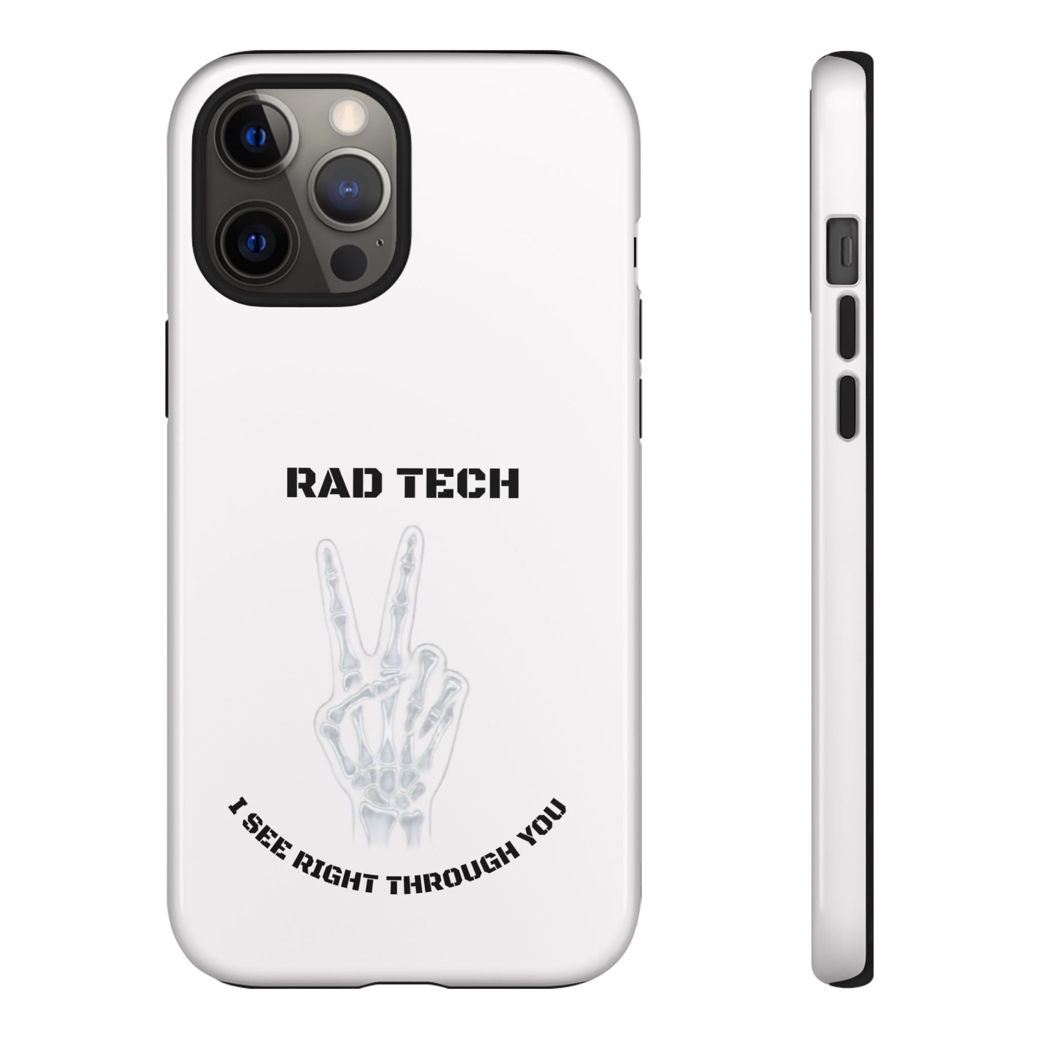 Rad Tech Phone Case — Skeleton Hand "I See Right Through You" X-ray Technician Gift