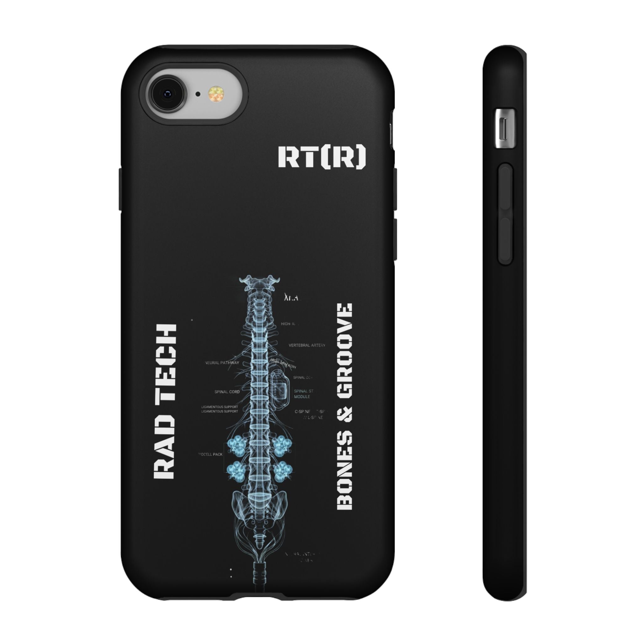 RAD TECH -Aesthetic Phone Case