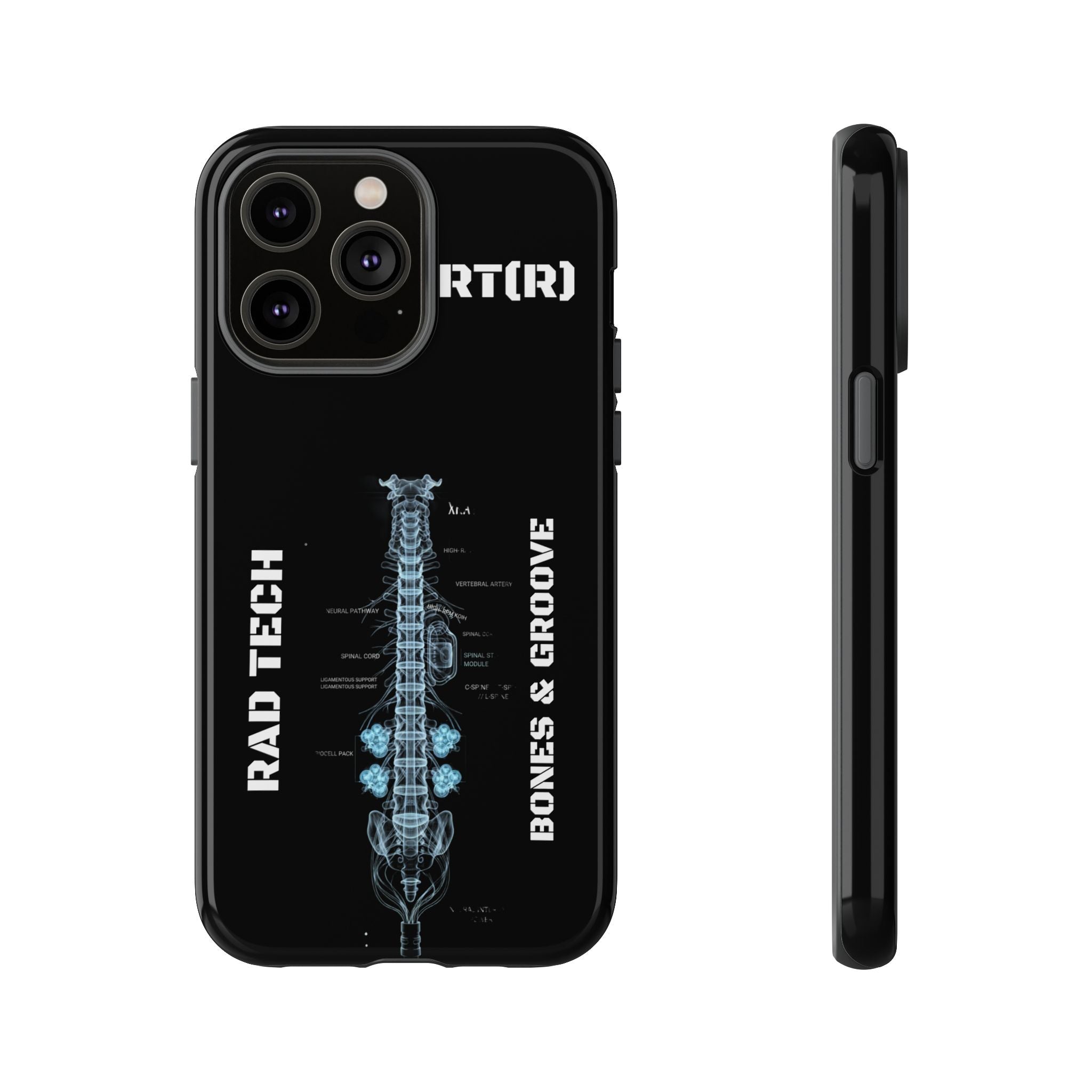 RAD TECH -Aesthetic Phone Case