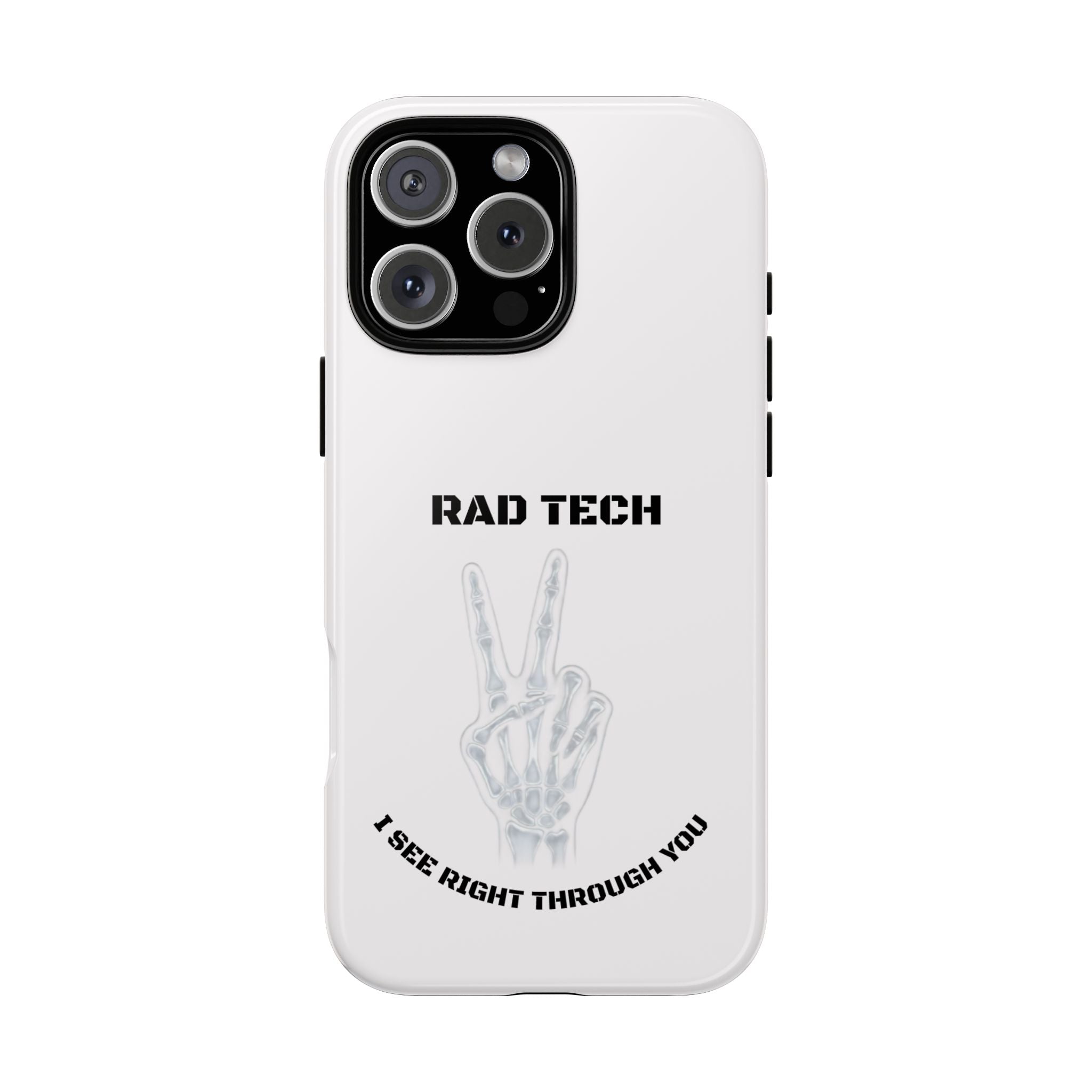 Rad Tech Phone Case — Skeleton Hand "I See Right Through You" X-ray Technician Gift