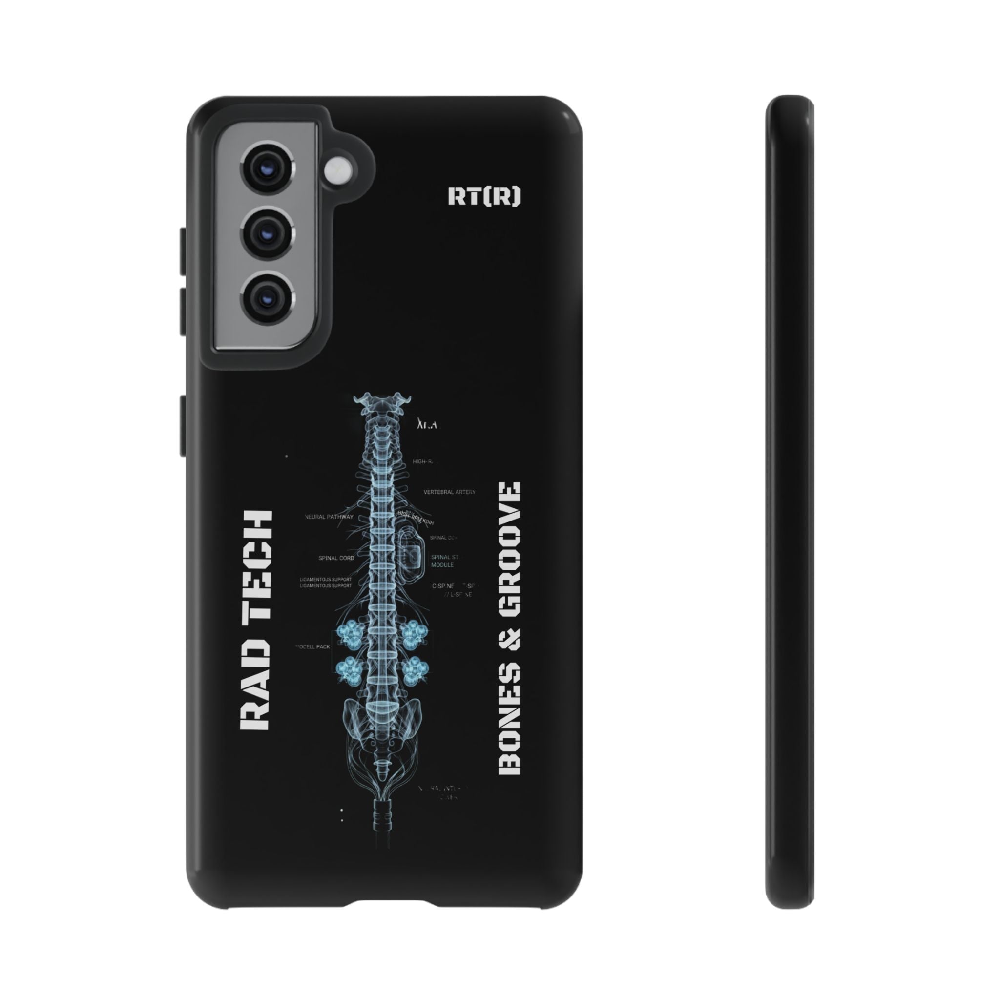 RAD TECH -Aesthetic Phone Case