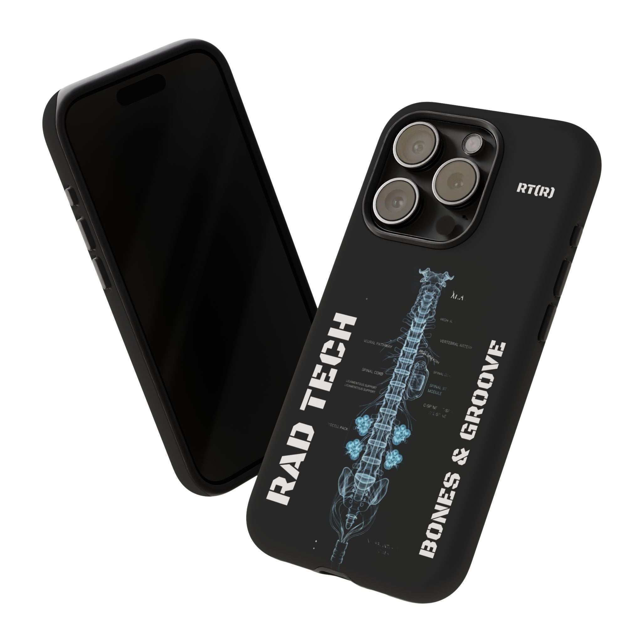 RAD TECH -Aesthetic Phone Case