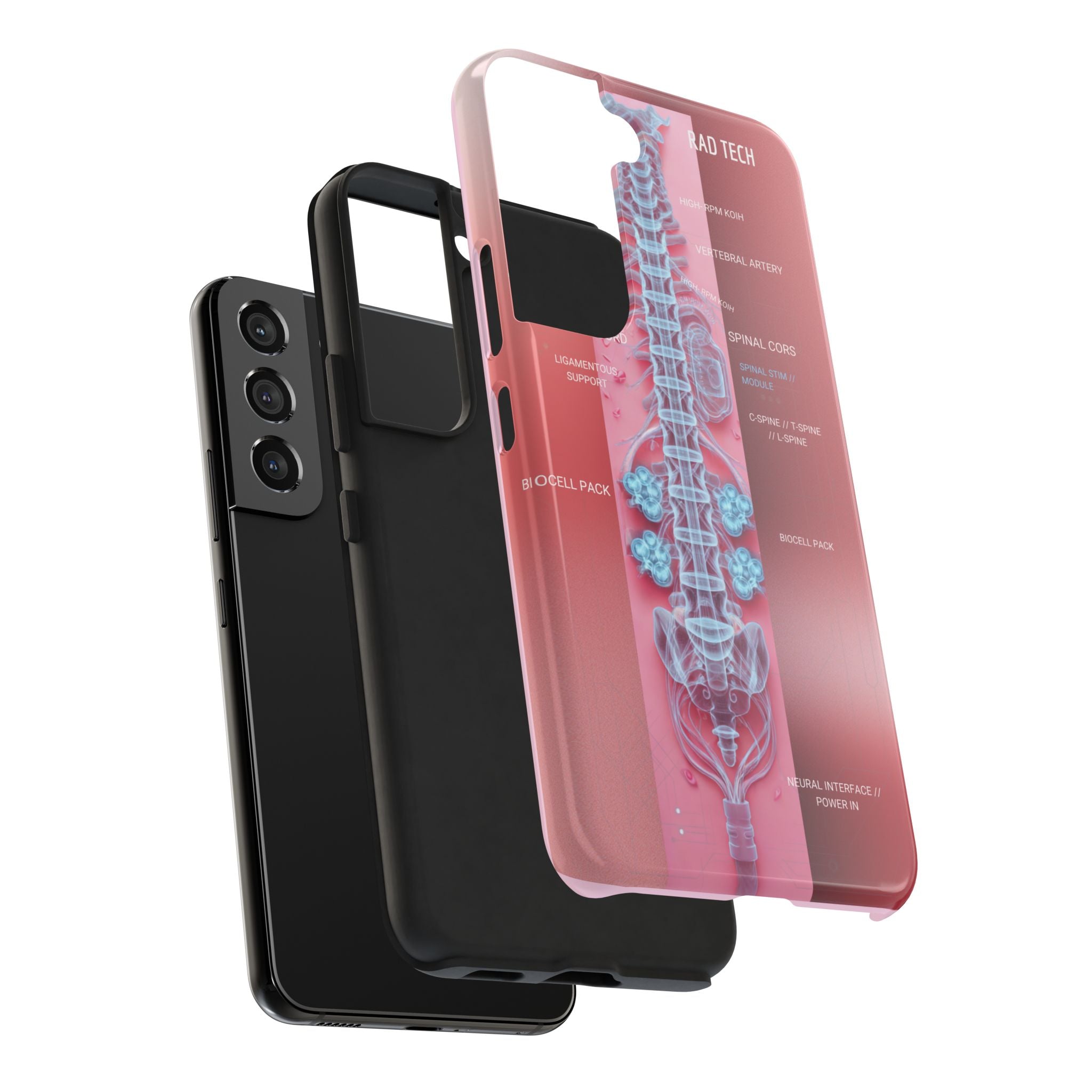 Anatomical Spine Tough Phone Case — Medical X-Ray Design, ‘Spinal Cord’ Labelled