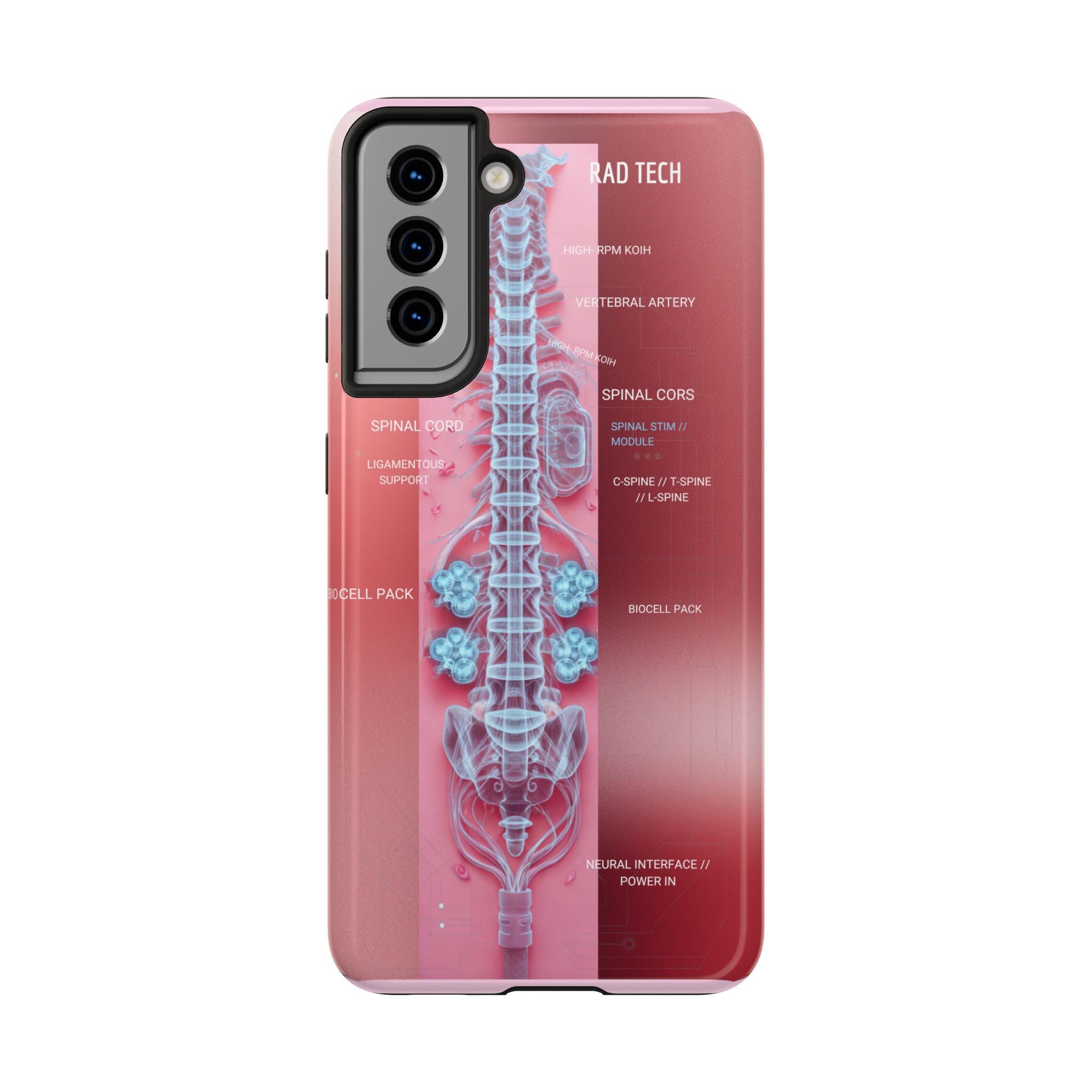 Anatomical Spine Tough Phone Case — Medical X-Ray Design, ‘Spinal Cord’ Labelled