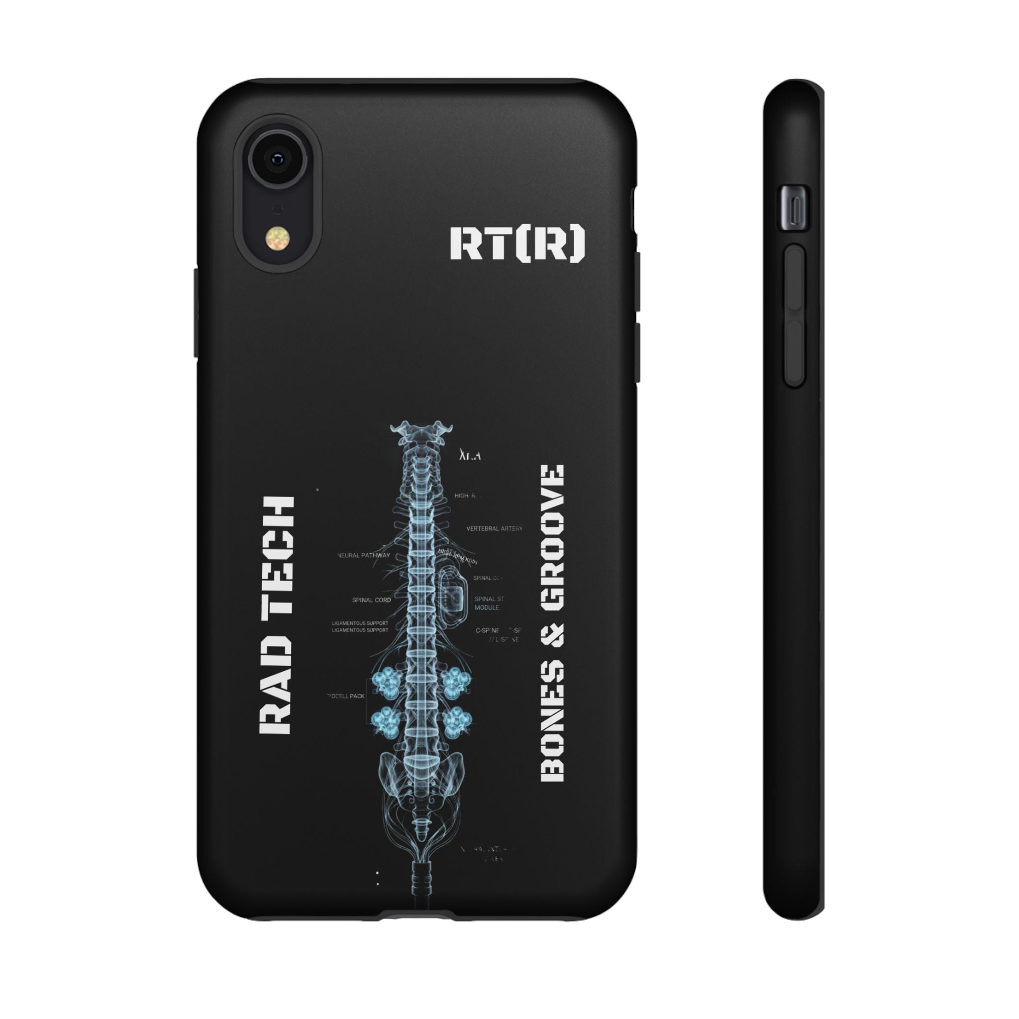 RAD TECH -Aesthetic Phone Case