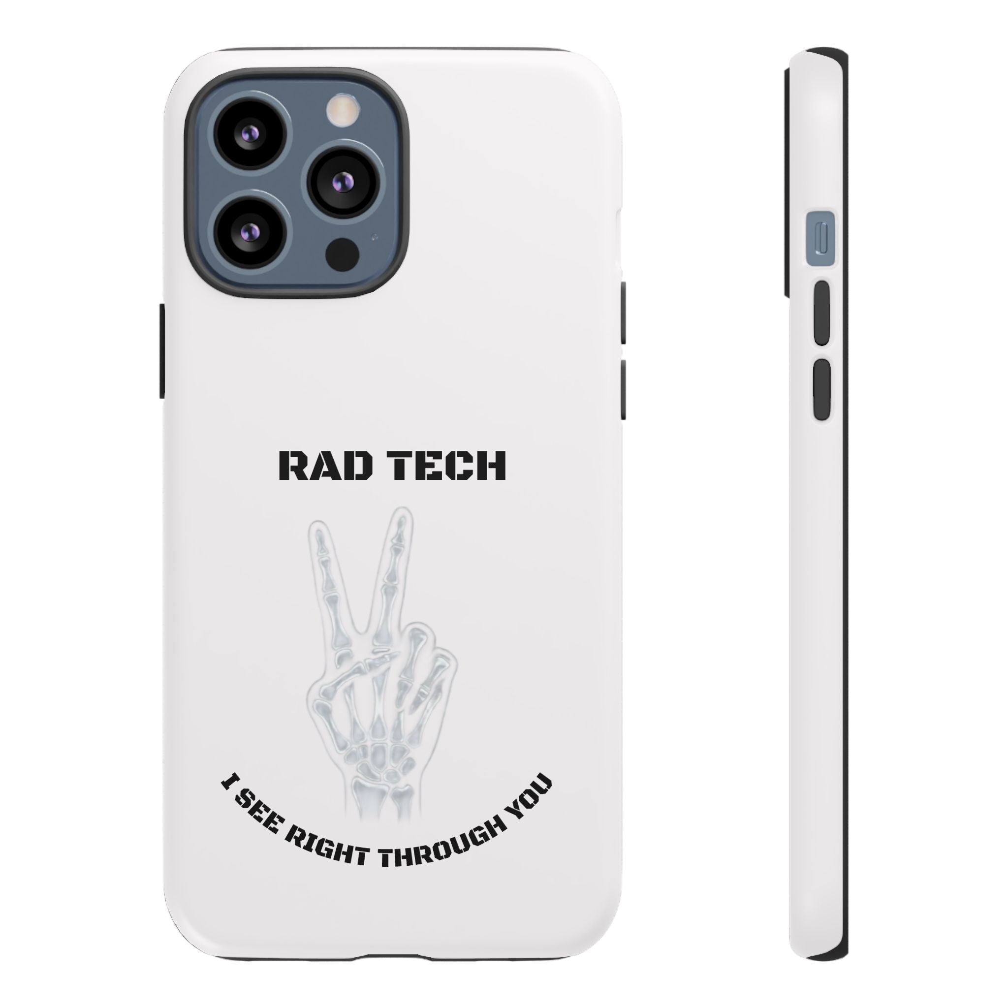 Rad Tech Phone Case — Skeleton Hand "I See Right Through You" X-ray Technician Gift