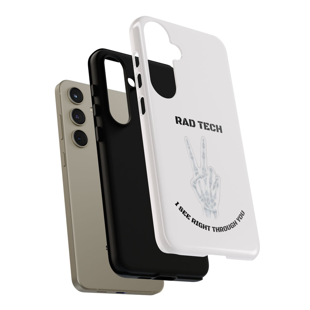 Rad Tech Phone Case — Skeleton Hand "I See Right Through You" X-ray Technician Gift