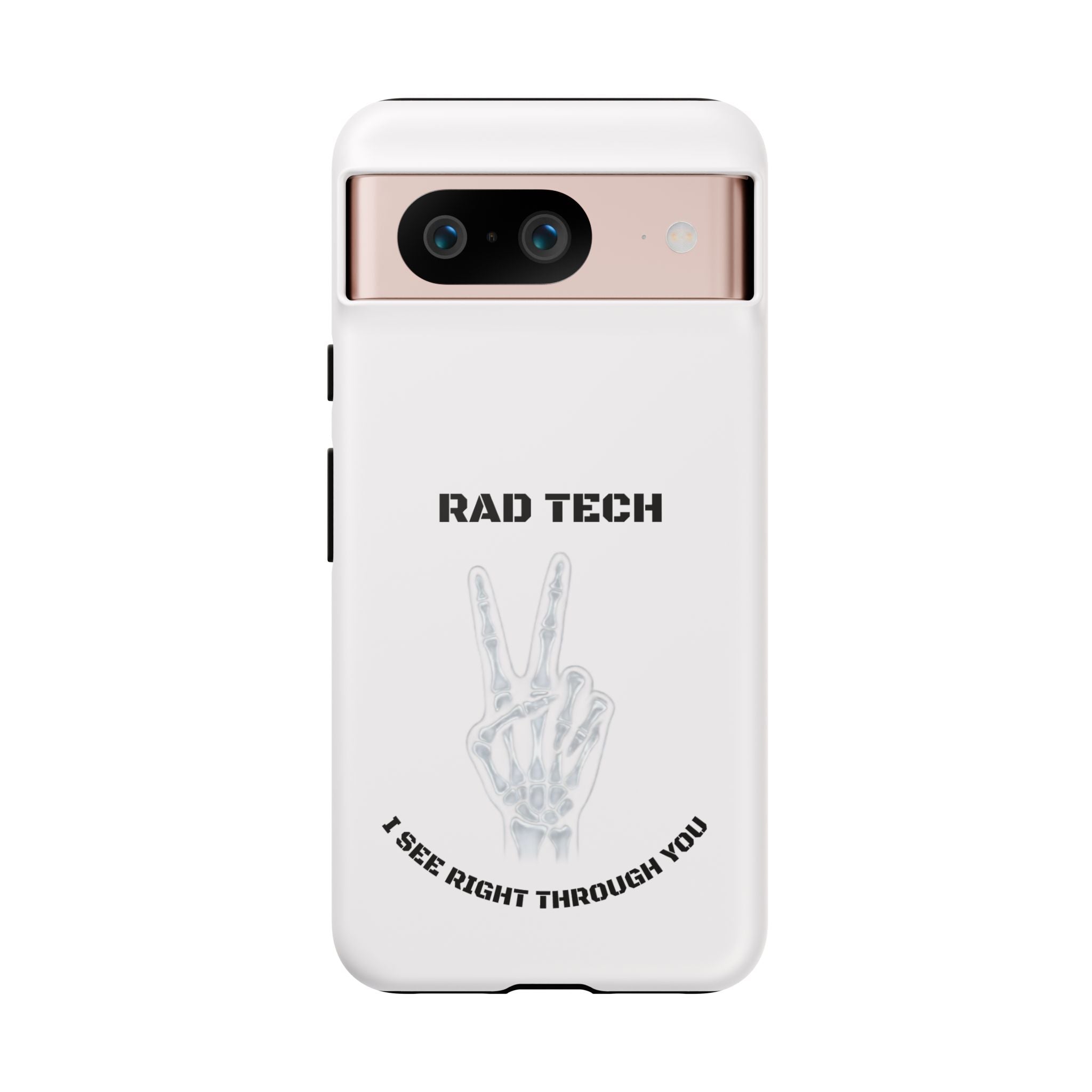 Rad Tech Phone Case — Skeleton Hand "I See Right Through You" X-ray Technician Gift