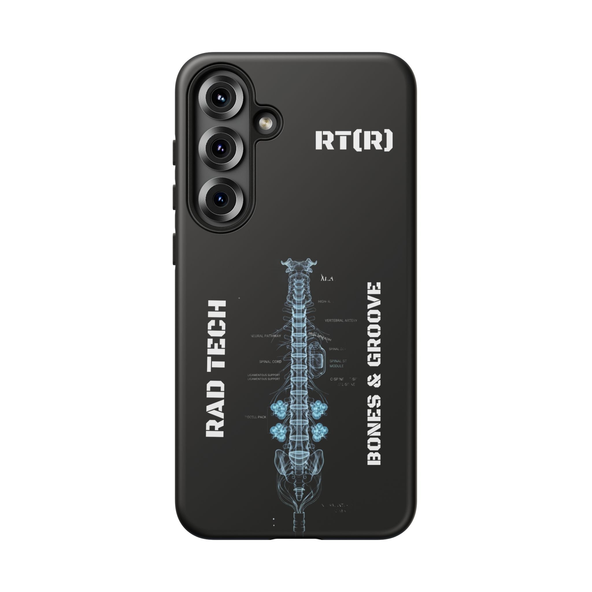 RAD TECH -Aesthetic Phone Case