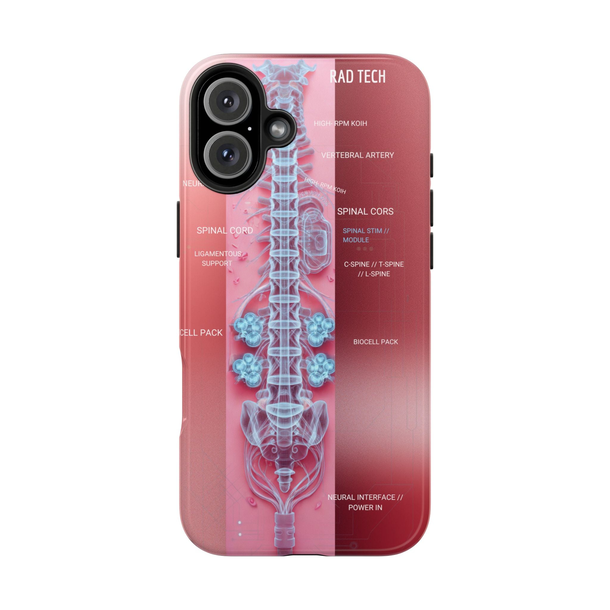 Anatomical Spine Tough Phone Case — Medical X-Ray Design, ‘Spinal Cord’ Labelled