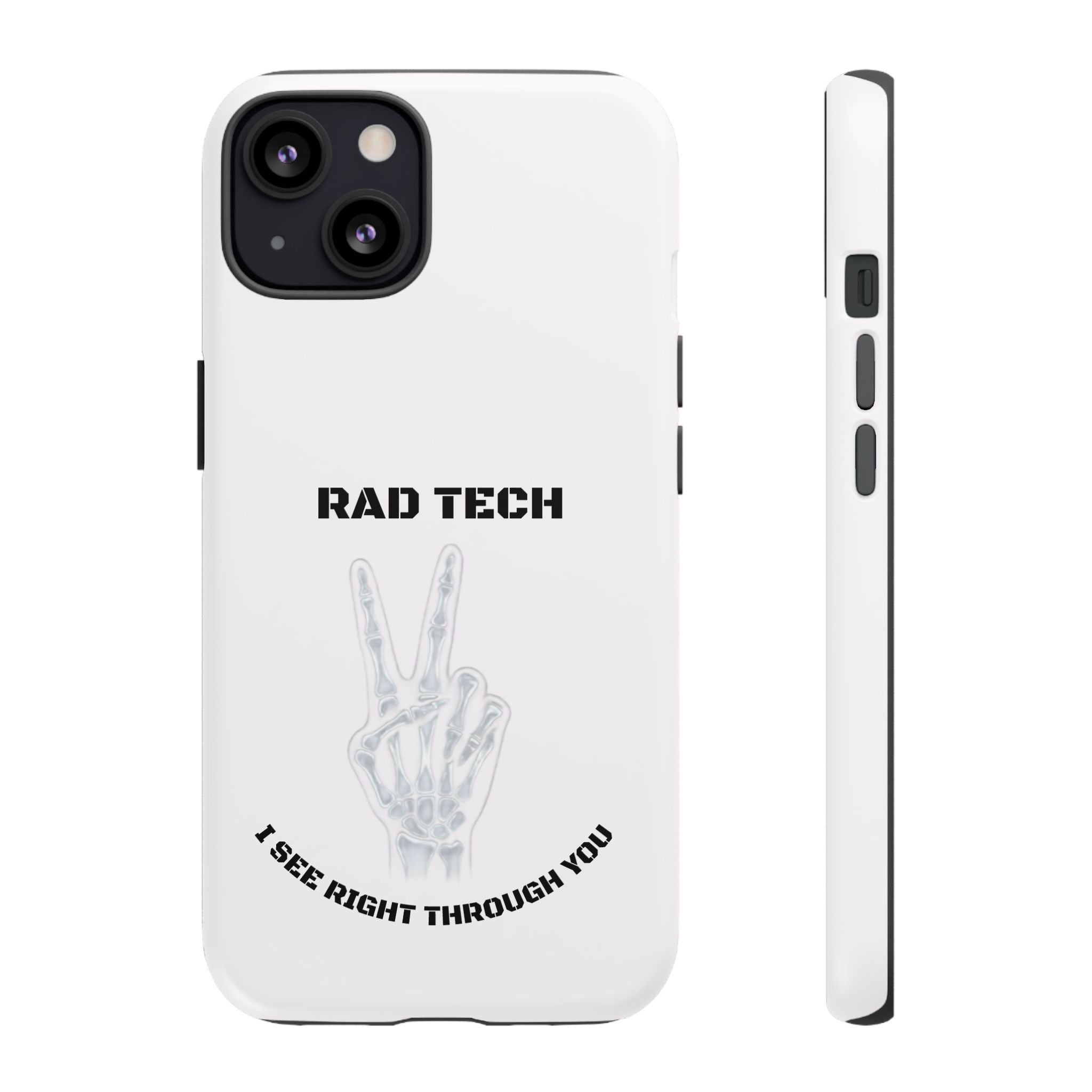 Rad Tech Phone Case — Skeleton Hand "I See Right Through You" X-ray Technician Gift
