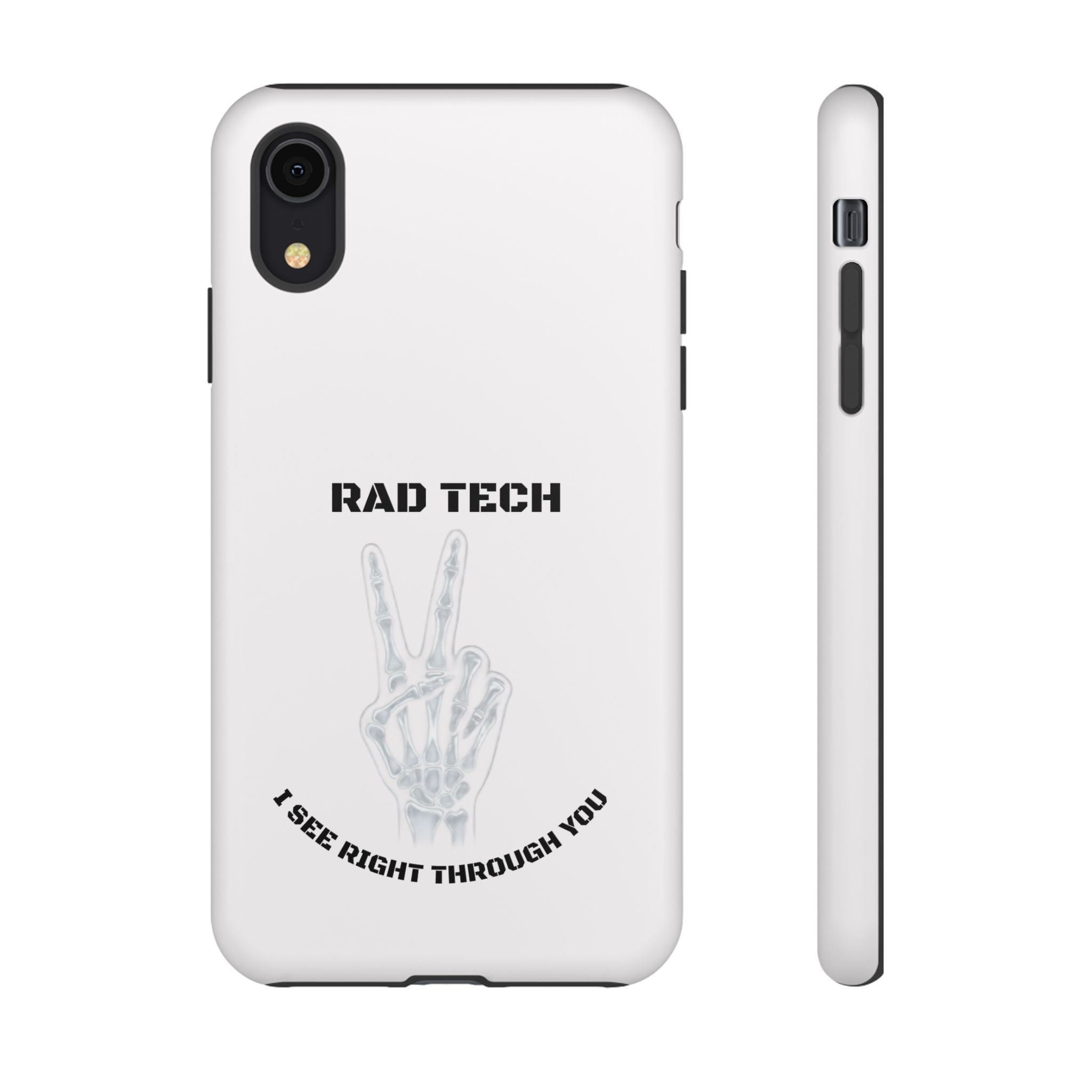 Rad Tech Phone Case — Skeleton Hand "I See Right Through You" X-ray Technician Gift