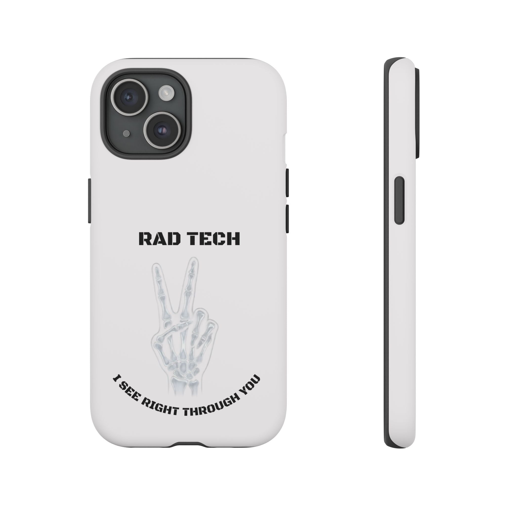 Rad Tech Phone Case — Skeleton Hand "I See Right Through You" X-ray Technician Gift