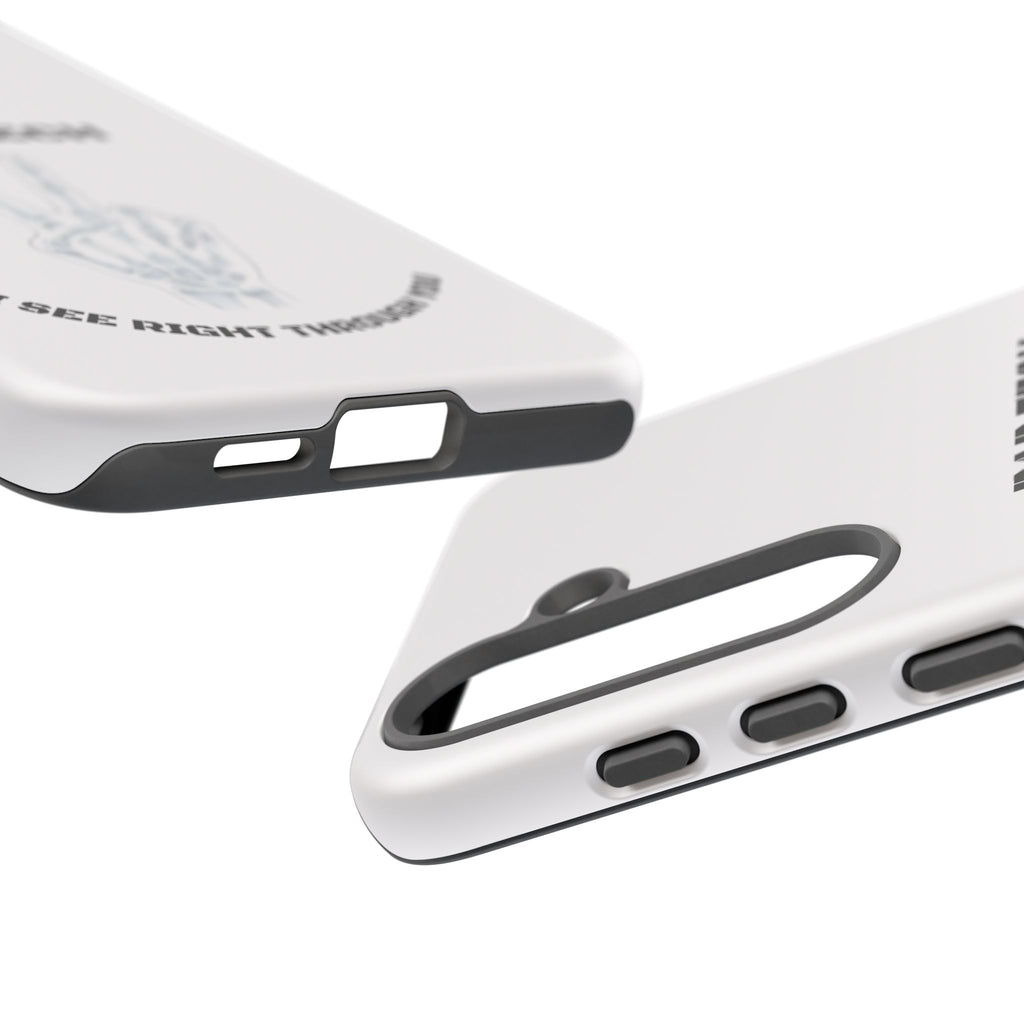 Rad Tech Phone Case — Skeleton Hand "I See Right Through You" X-ray Technician Gift