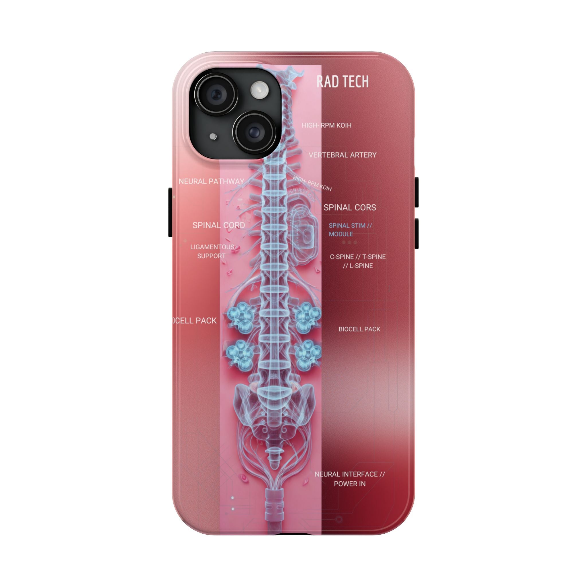 Anatomical Spine Tough Phone Case — Medical X-Ray Design, ‘Spinal Cord’ Labelled