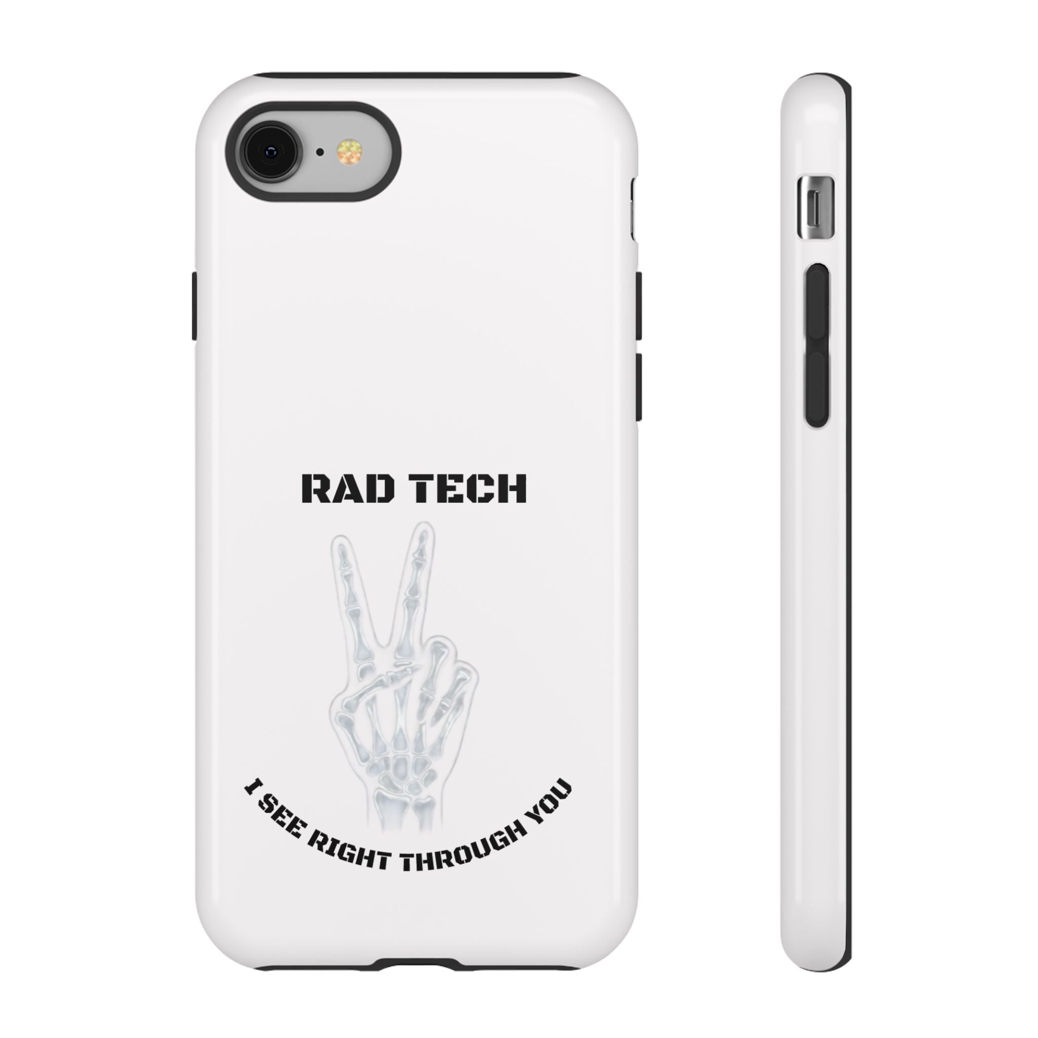 Rad Tech Phone Case — Skeleton Hand "I See Right Through You" X-ray Technician Gift