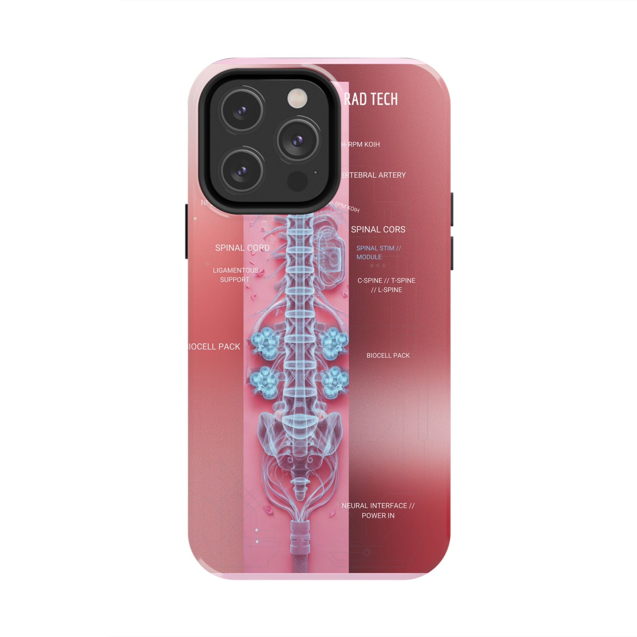 Anatomical Spine Tough Phone Case — Medical X-Ray Design, ‘Spinal Cord’ Labelled