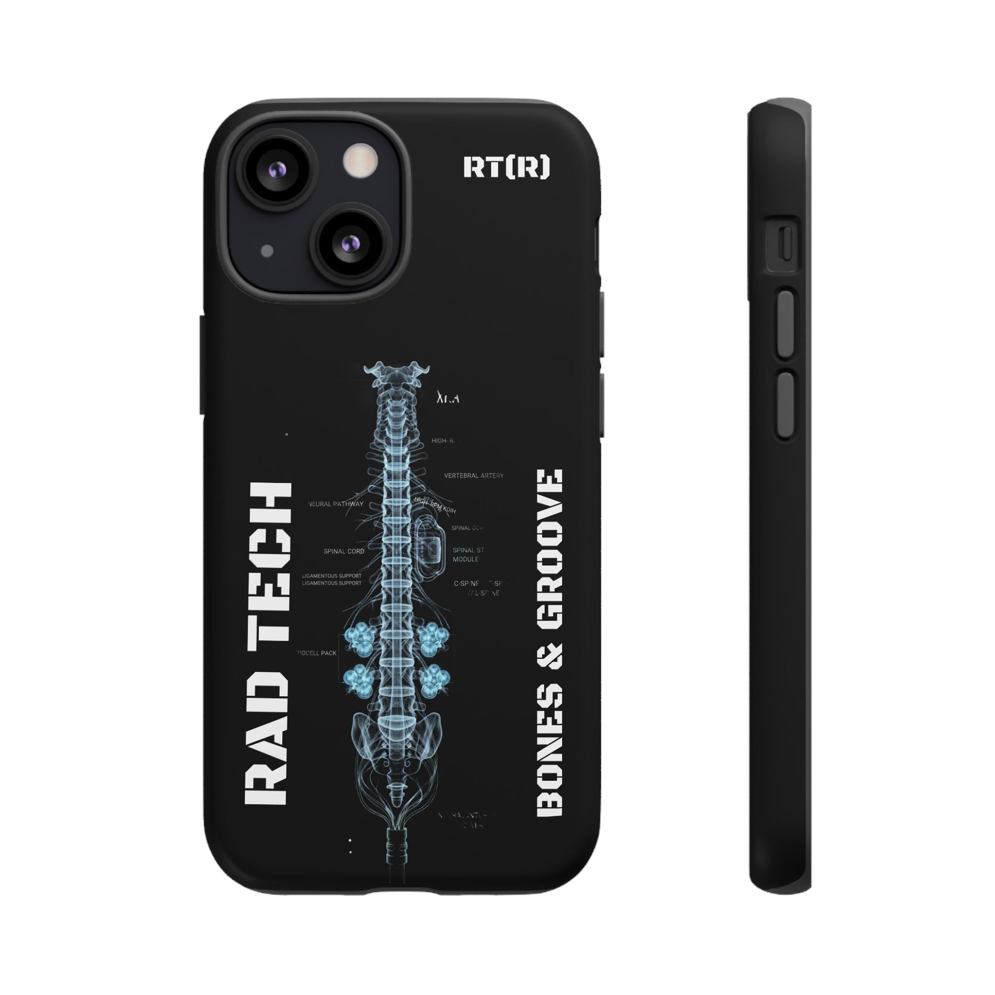 RAD TECH -Aesthetic Phone Case