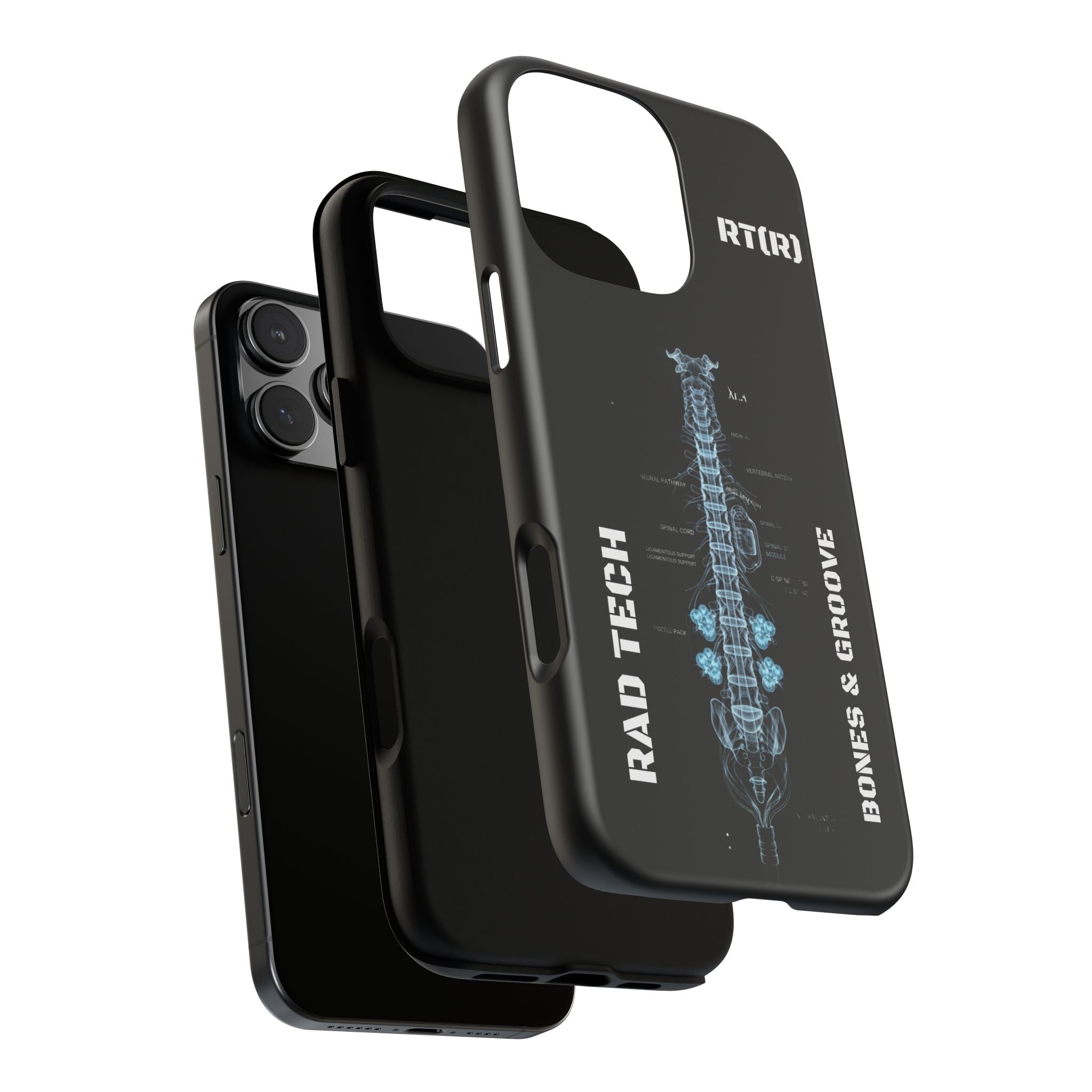 RAD TECH -Aesthetic Phone Case