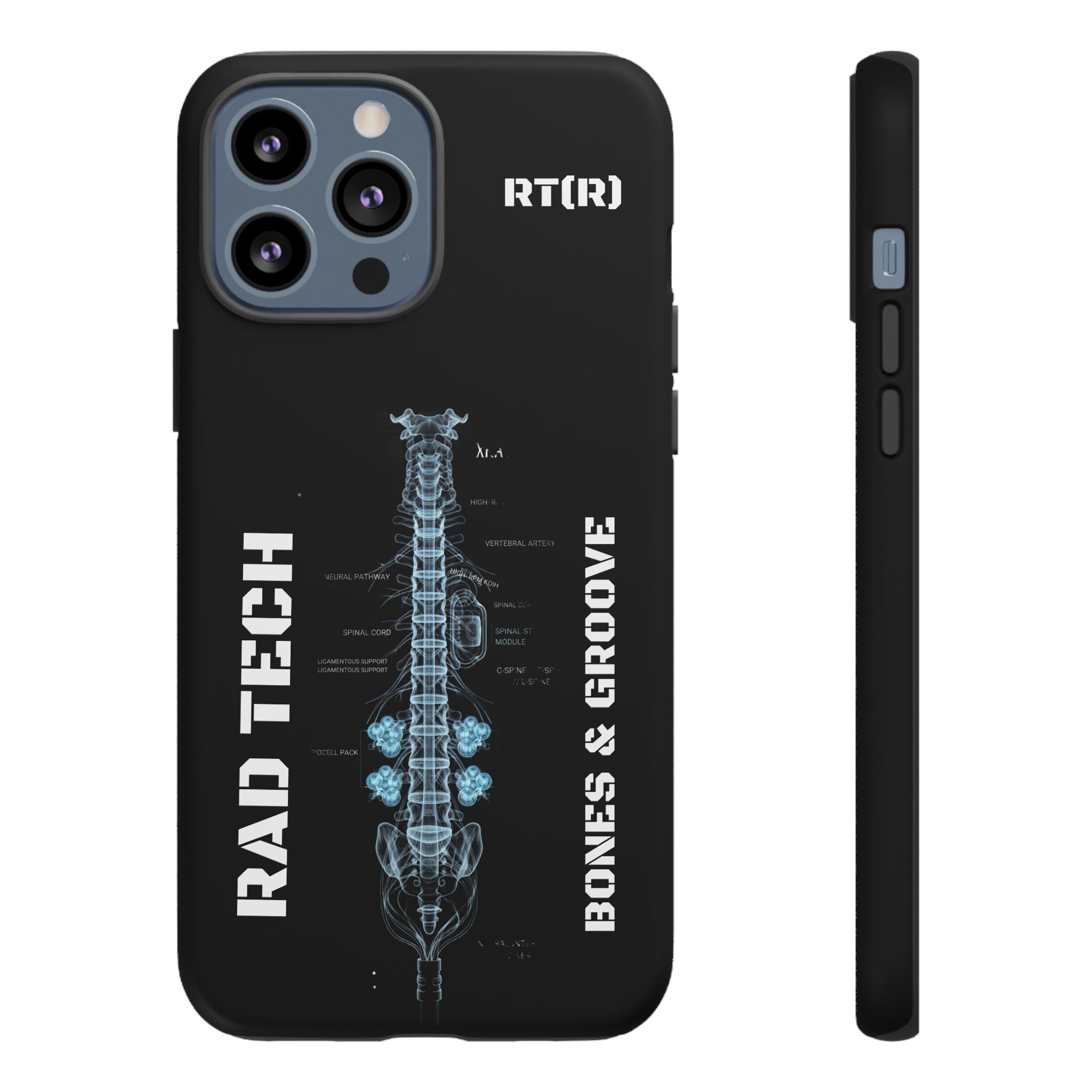 RAD TECH -Aesthetic Phone Case