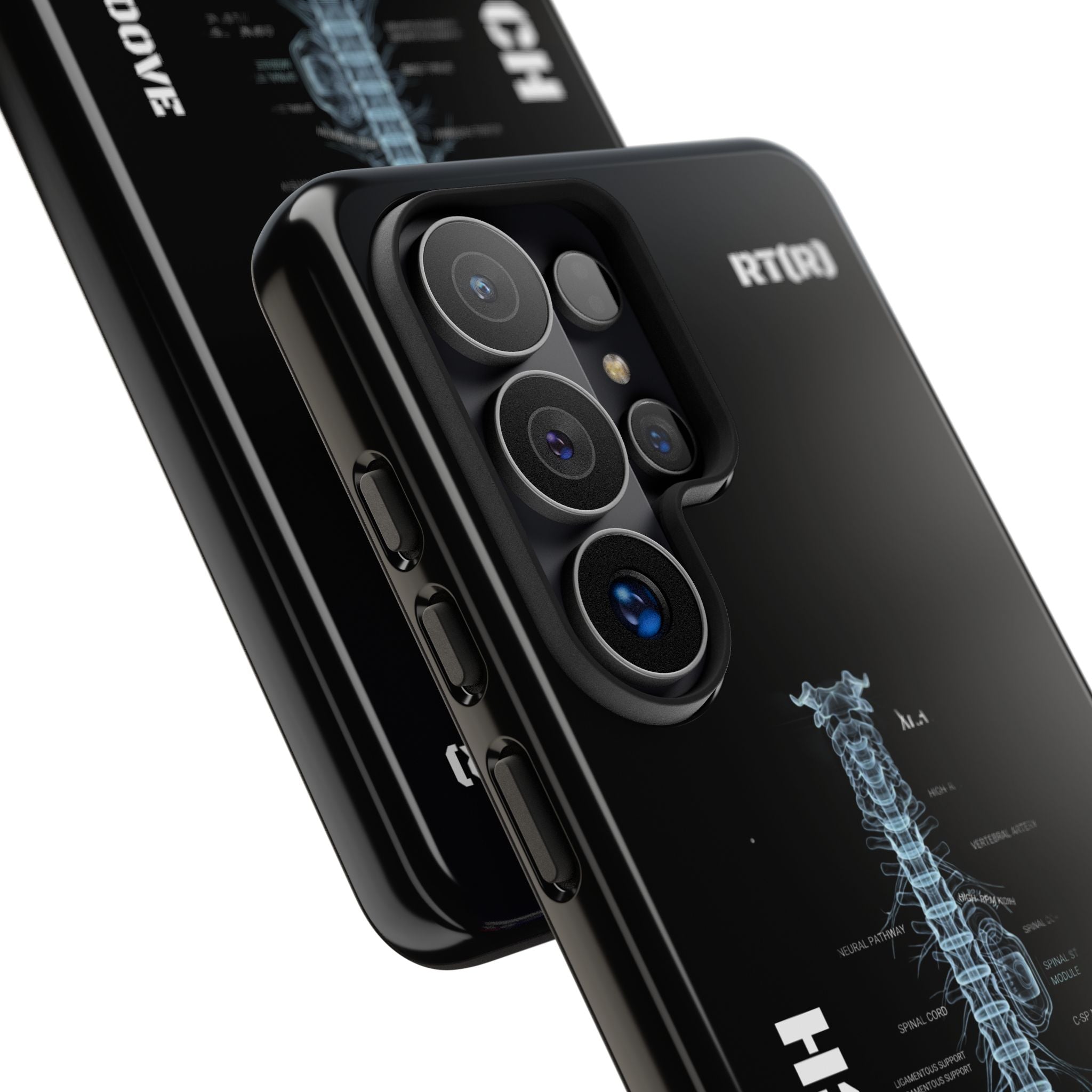 RAD TECH -Aesthetic Phone Case