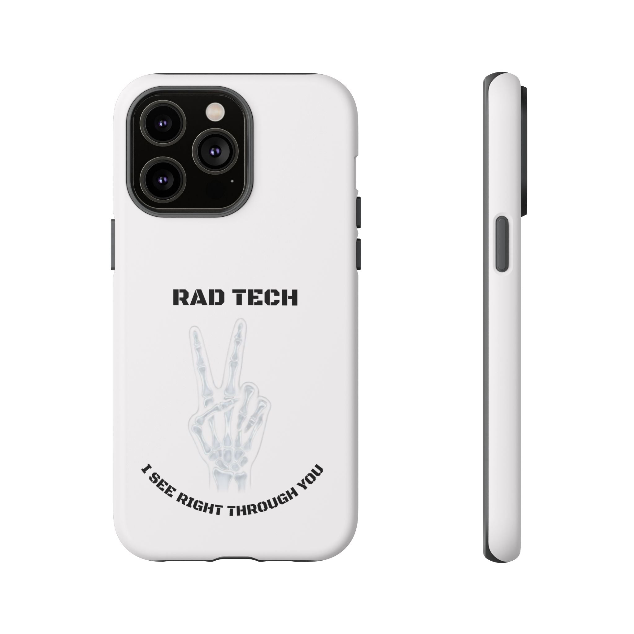Rad Tech Phone Case — Skeleton Hand "I See Right Through You" X-ray Technician Gift