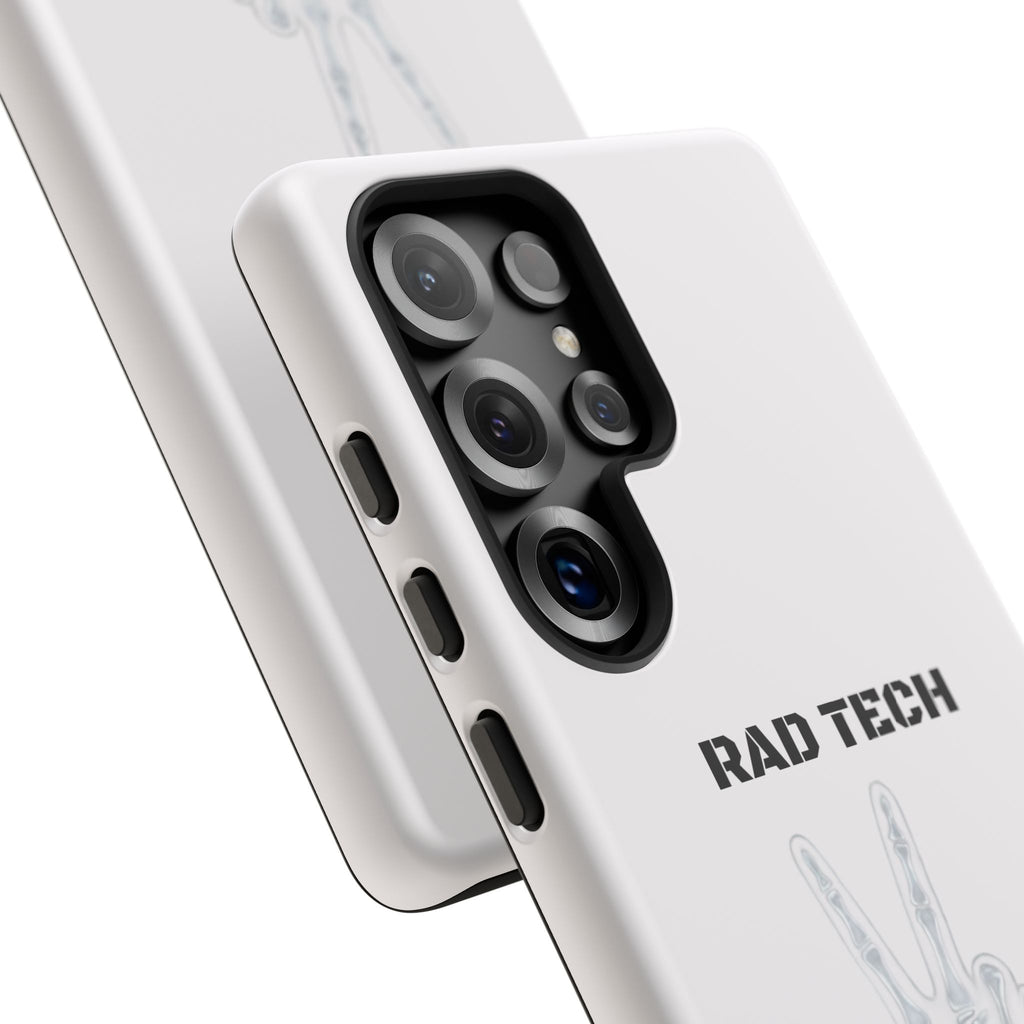Rad Tech Phone Case — Skeleton Hand "I See Right Through You" X-ray Technician Gift