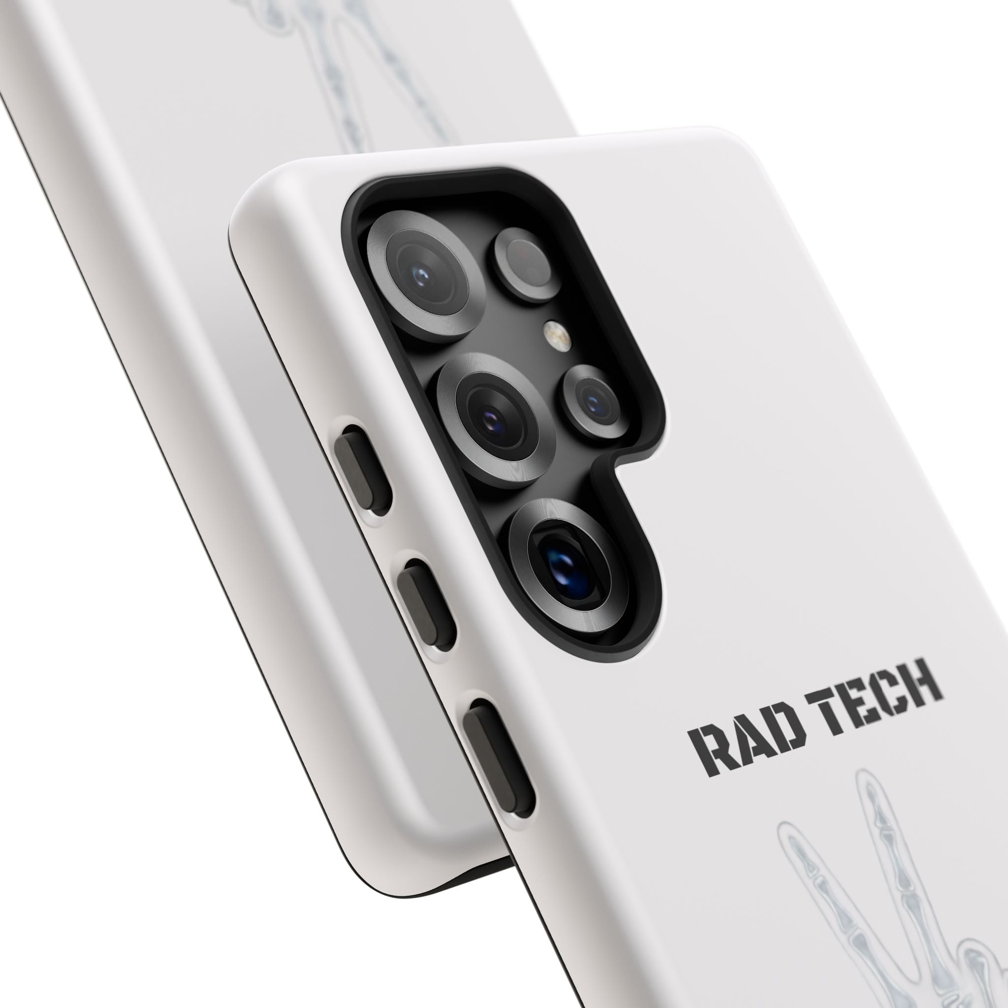 Rad Tech Phone Case — Skeleton Hand "I See Right Through You" X-ray Technician Gift
