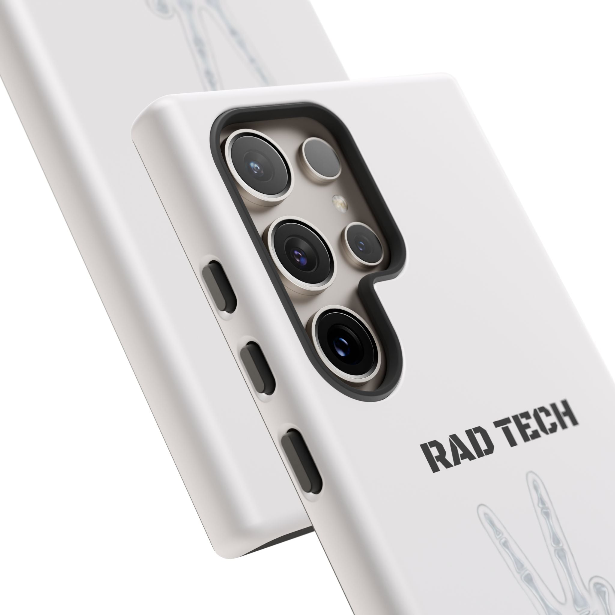 Rad Tech Phone Case — Skeleton Hand "I See Right Through You" X-ray Technician Gift
