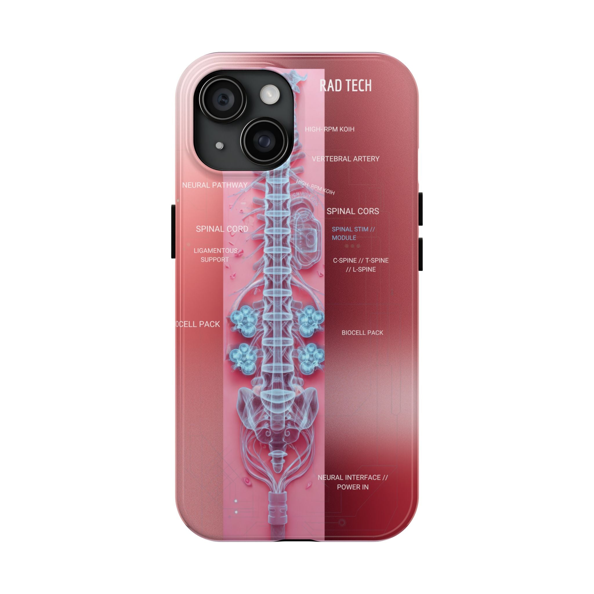 Anatomical Spine Tough Phone Case — Medical X-Ray Design, ‘Spinal Cord’ Labelled