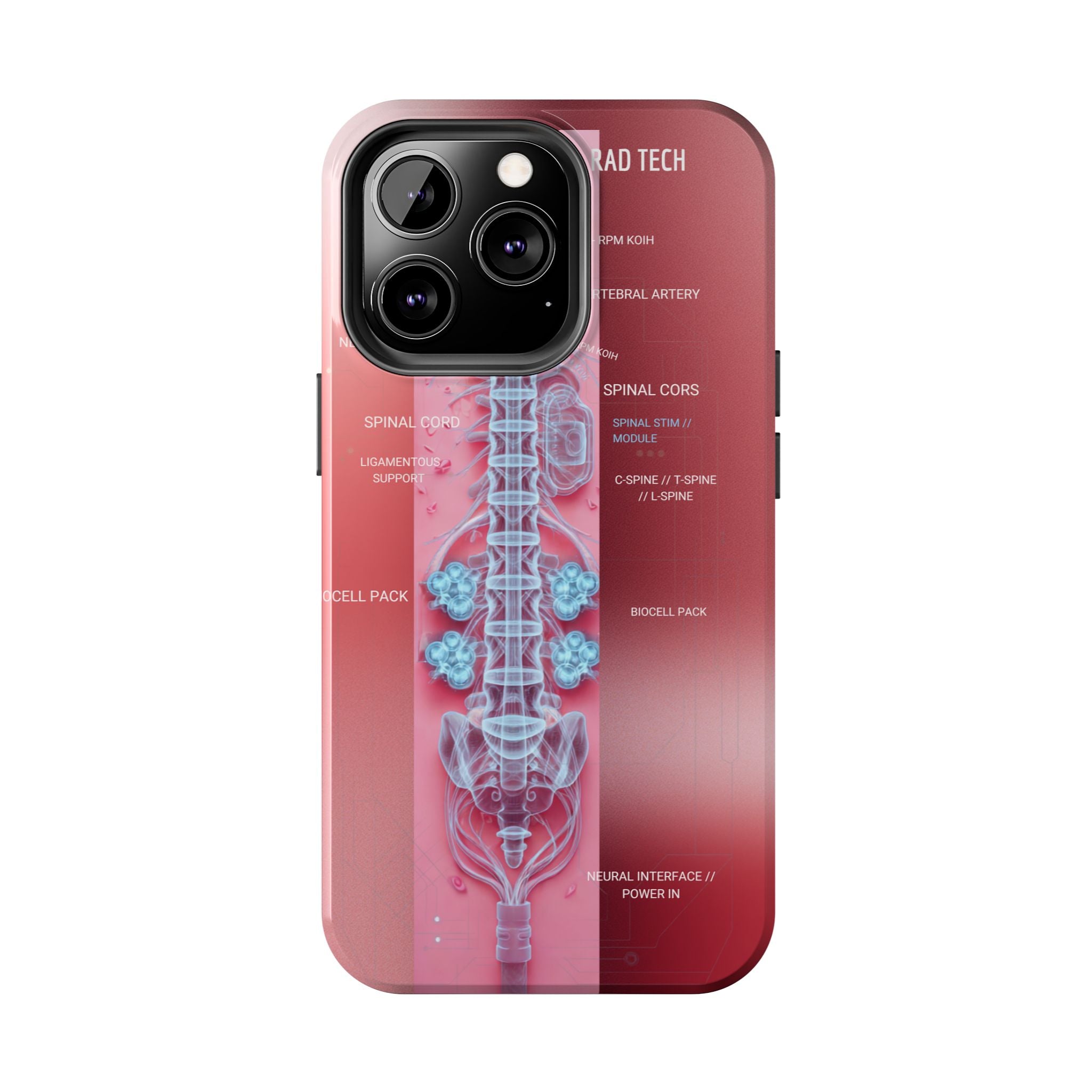 Anatomical Spine Tough Phone Case — Medical X-Ray Design, ‘Spinal Cord’ Labelled