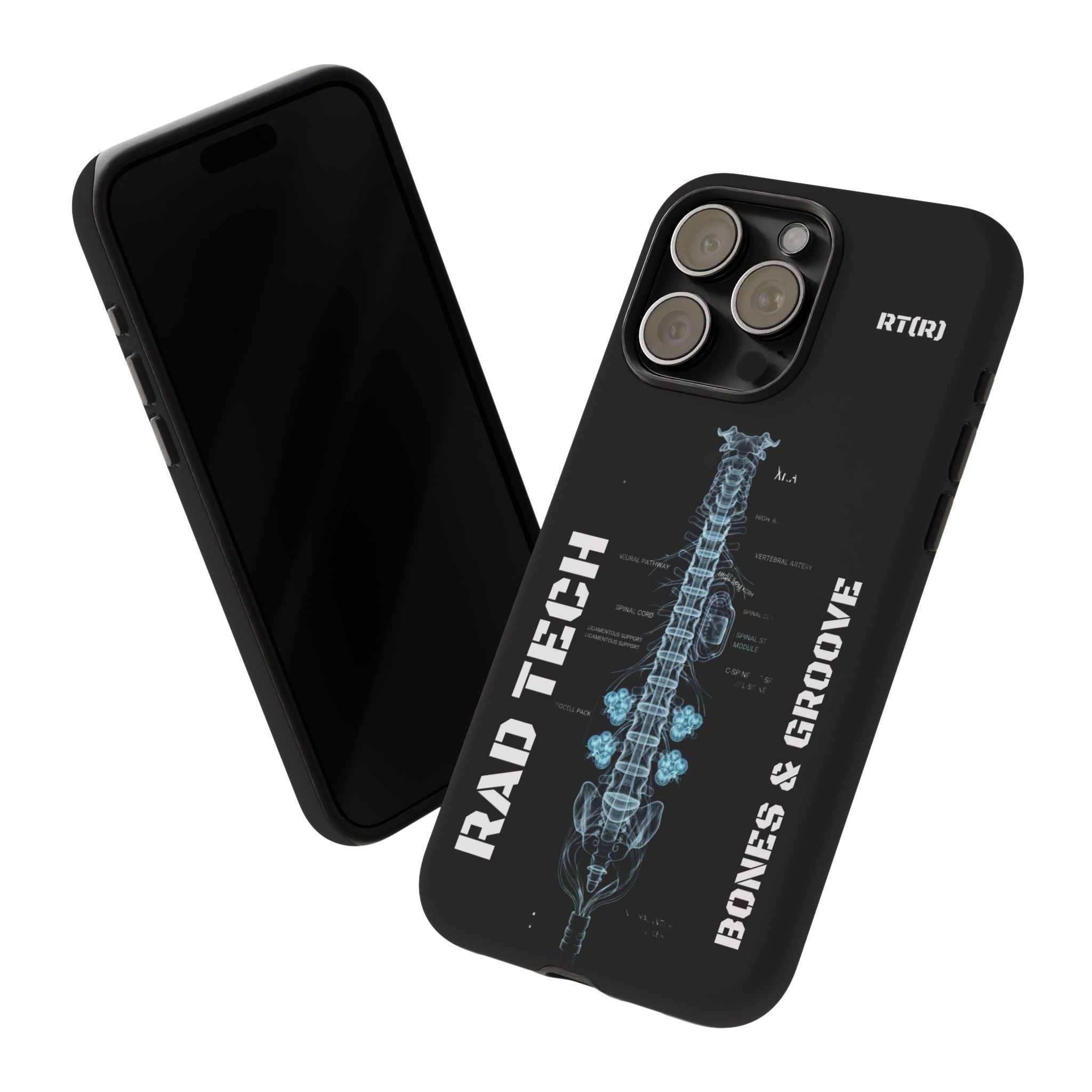 RAD TECH -Aesthetic Phone Case