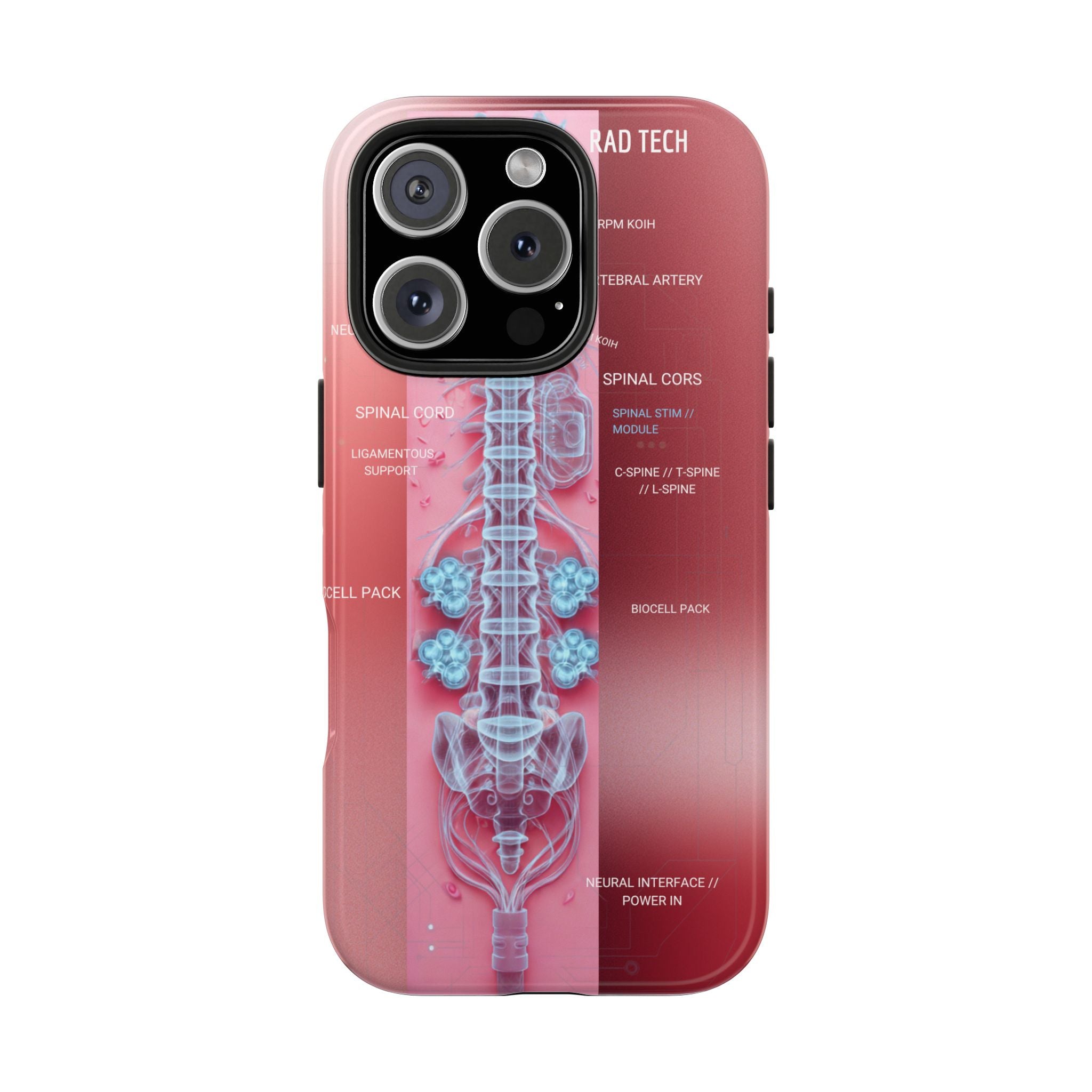 Anatomical Spine Tough Phone Case — Medical X-Ray Design, ‘Spinal Cord’ Labelled