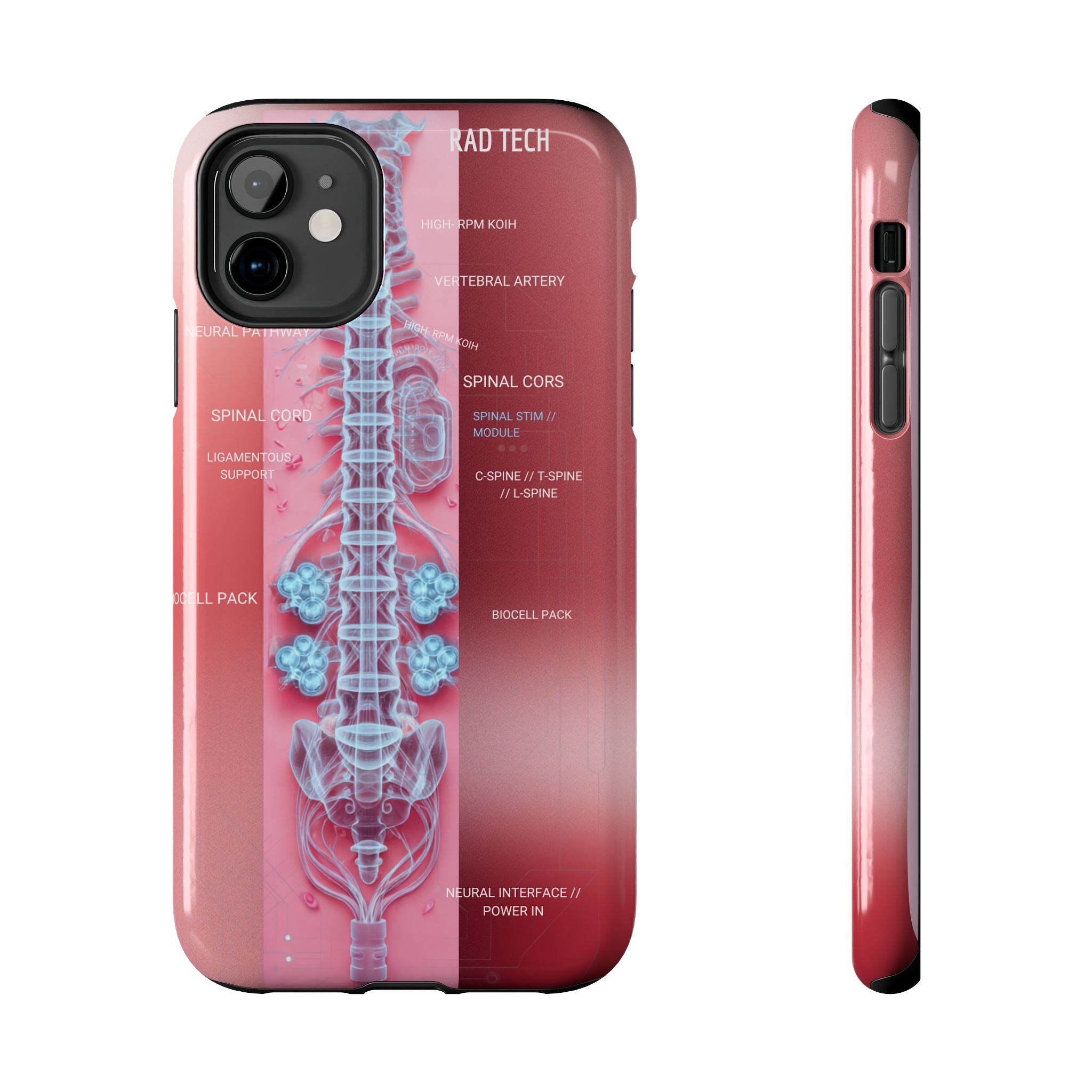 Anatomical Spine Tough Phone Case — Medical X-Ray Design, ‘Spinal Cord’ Labelled
