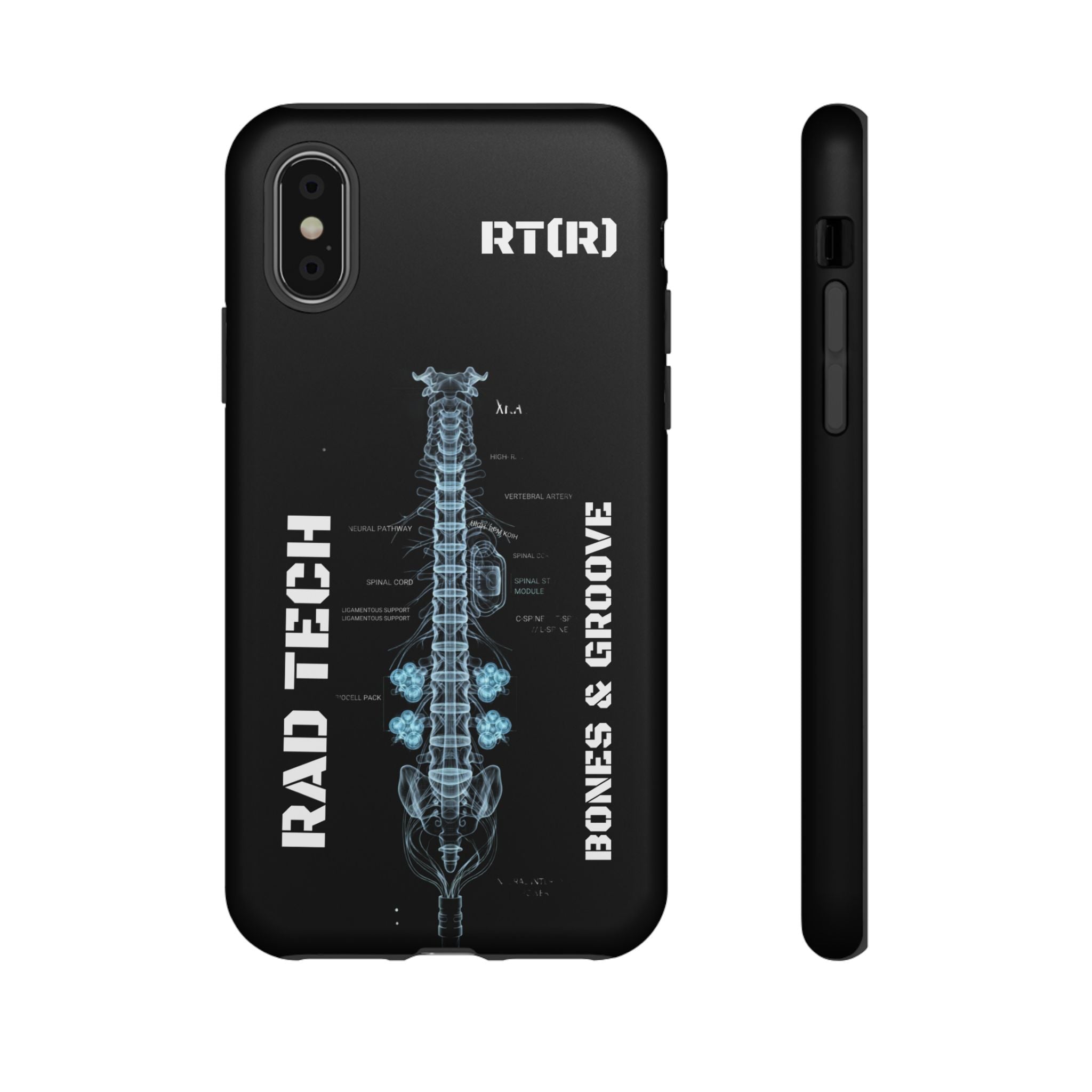 RAD TECH -Aesthetic Phone Case