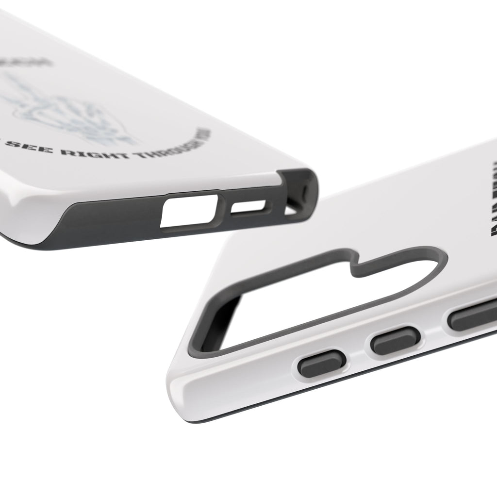 Rad Tech Phone Case — Skeleton Hand "I See Right Through You" X-ray Technician Gift